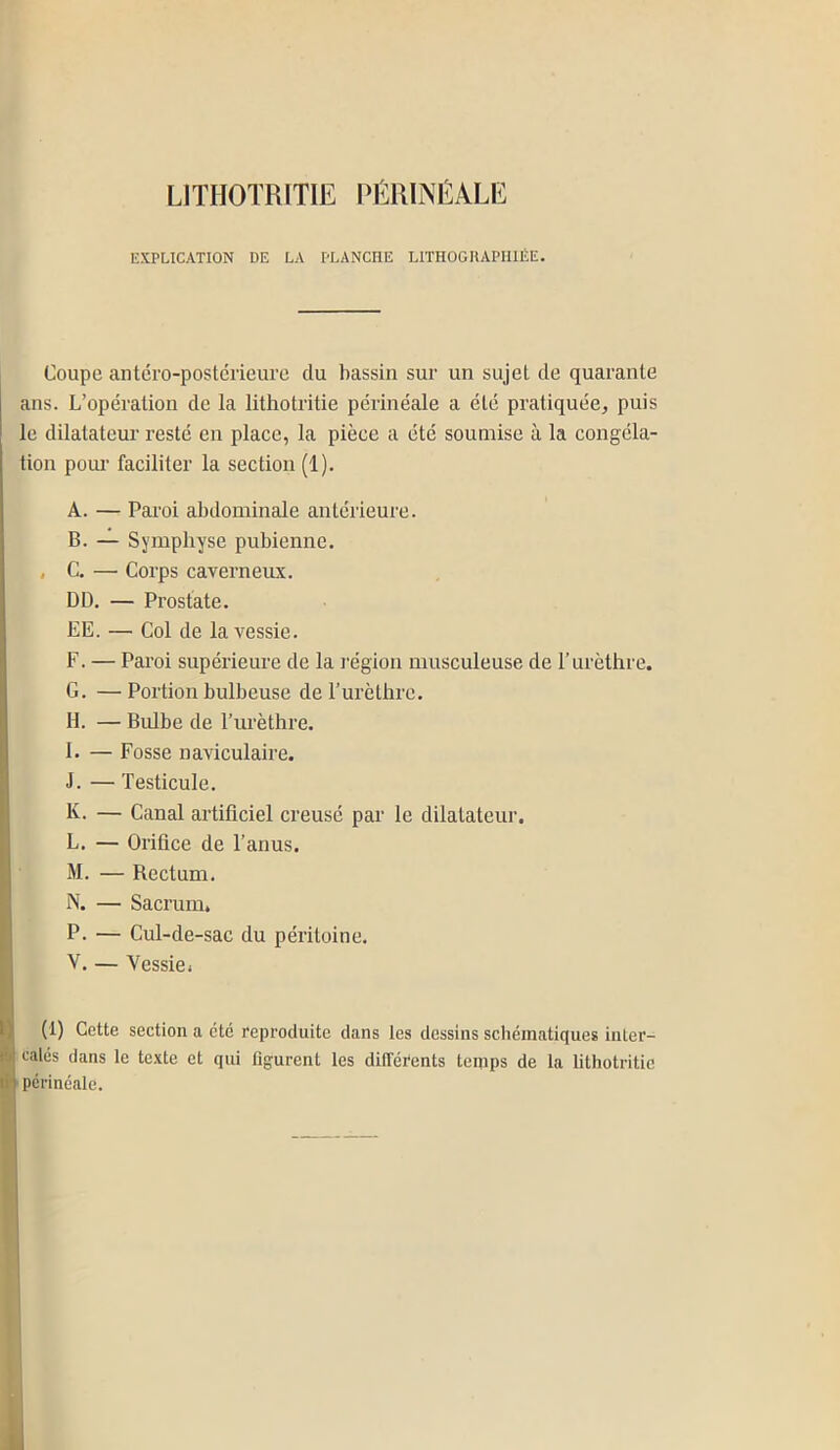LITHOTRITIE PÉRINÉALE EXPLICATION DE LA PLANCHE LITHOGRAPHIÉE. Coupe antéro-postérieure du bassin sur un sujet de quarante ans. L’opération de la lithotritie périnéale a été pratiquée, puis le dilatateur resté en place, la pièce a été soumise à la congéla- tion pour faciliter la section (1). A. — Paroi abdominale antérieure. B. — Symphyse pubienne. , C. — Corps caverneux. DD. — Prostate. EE. — Col de la vessie. F. — Paroi supérieure de la région musculeuse de l’urèthre. G. — Portion bulbeuse de l’urèthre. IL — Bulbe de l’urèthre. I. — Fosse naviculaire. J. — Testicule. K- — Canal artificiel creusé par le dilatateur. L. — Orifice de l’anus. M. — Rectum. N. — Sacrum. P. — Cul-de-sac du péritoine. V. — Vessie. (1) Cette section a été reproduite clans les dessins schématiques inter- calés dans le texte et qui figurent les différents temps de la lithotritie périnéale.