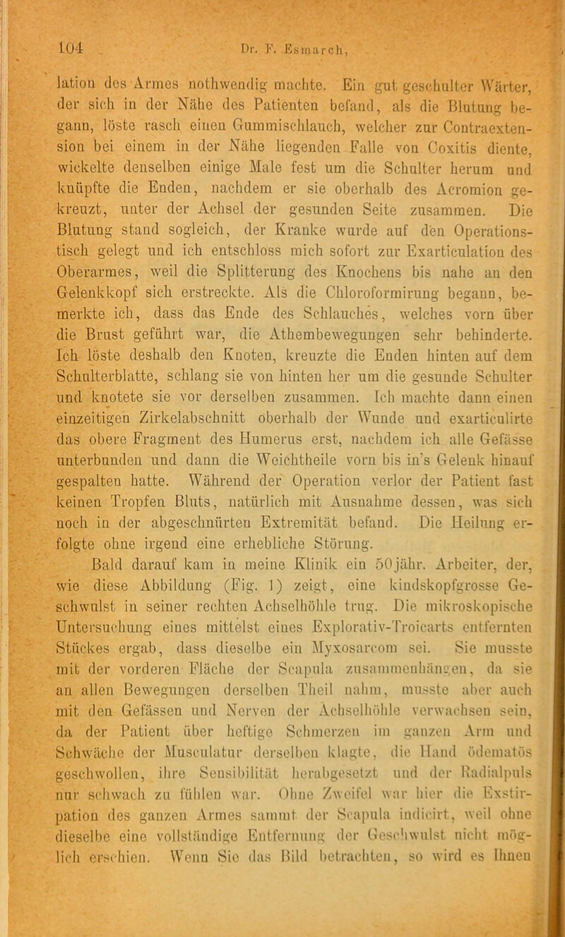 latiou des xVrmes nothwendig machte. Ein gut geschulter Würter, dev sich in dev Nähe des Patieuten befand, als die Blutung be- gann, löste vasch einen Gummisclilauch, welcher zur Contraexten- sion bei einem in der Nähe liegenden Falle von Coxitis diente, wickelte denselben einige Male fest um die Schulter herum und knüpfte die Enden, nachdem er sie oberhalb des Aevoraion ge- kreuzt, unter der Achsel der gesunden Seite zusammen. Die Blutung stand sogleich, der Kranke wurde auf den Operations- tisch gelegt und ich entschloss mich sofort zur Exarticulatiou des Oberarmes, weil die Splitterung des Knochens bis nahe an den Gelenkkopf sich erstreckte. Als die Chloroformirung begann, be- merkte ich, dass das Ende des Schlauches, welches vorn über die Brust geführt war, die Athembewegungen sehr behinderte. Ich löste deshalb den Knoten, kreuzte die Enden hinten auf dem Schulterblatte, schlang sie von hinten her um die gesunde Schulter und knotete sie vor derselben zusammen. Ich machte dann einen eiuzeitigen Zirkelabschnitt oberhalb der Wunde und exarticulirte das obere Fragment des Humerus erst, nachdem ich alle Gefässe unterbunden und dann die Weichtheile vorn bis in’s Gelenk hinauf gespalten hatte. Während der Operation verlor der Patient fast keinen Tropfen Bluts, natürlich mit Ausnahme dessen, was sich noch in der abgeschnürteu Extremität befand. Die Heilung er- folgte ohne irgend eine erhebliche Störung. Bald darauf kam in meine Klinik ein öOjähr. Arbeiter, der, wie diese Abbildung (Fig. 1) zeigt, eine kindskopfgrosse Ge- schwulst in seiner rechten Achselhöhle trug. Die mikroskopische Untersuchung eines mittelst eines Explorativ-Troicarts entfernten Stückes ergab, dass dieselbe ein Myxosarcom sei. Sie musste mit der vorderen Fläche der Scapula Zusammenhängen, da sie an allen Bewegungen derselben Theil nahm, musste aber auch mit den Gefässen und Nerven der x\.chselhöhle verwachsen sein, da der Patient über heftige Schmerzen im ganzen Arm und Schwäche der Musculatur derselben klagte, die Hand ödematös geschwollen, ihre Sensibilität herabgesetzt und der Kadialpuls nur schwach zu fühlen war. Ohne Zweifel war hier die Exstir- ; pation des ganzen xVrmes sammt der Scapula iudicirt, weil ohne dieselbe eine vollständige Entfernung der Geschwulst nicht mög- . lieh erschien. Wenu Sie das Bild betrachten, so wird es Urnen .