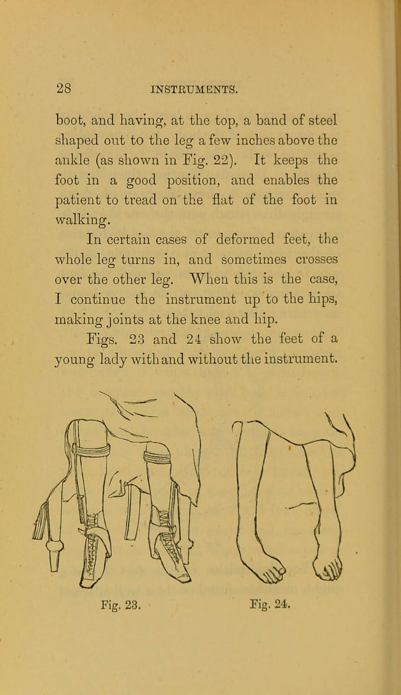 boot, and having, at the top, a band of steel shaped out to the leg a few inches above the ankle (as shown in Fig. 22). It keeps the foot in a good position, and enables the patient to tread on the flat of the foot in walking. In certain cases of deformed feet, the whole leg turns in, and sometimes crosses over the other leg. When this is the case, I continue the instrument up to the hips, making joints at the knee and hip. Figs. 23 and 24 show the feet of a young lady with and without the instrument.