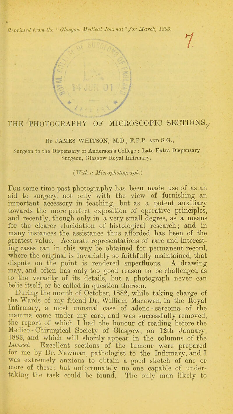 1 \+ '**■ +/ THE PHOTOGRAPHY OF MICROSCOPIC SECTIONS./ By JAMES WHITSON, M.D., F.F.P. and S.G., Surgeon to the Dispensary of Anderson’s College ; Late Extra Dispensary Surgeon, Glasgow Royal Infirmary. {With a Microphotograph.) For some time past photography has been made use of as an aid to surgery, not only with the view of furnishing an important accessory in teaching, but as a potent auxiliary towards the more perfect exposition of operative principles, and recently, though only in a very small degree, as a means for the clearer elucidation of histological research; and in many instances the assistance thus afforded has been of the greatest value. Accurate representations of rare and interest- ing cases can in this way be obtained for permanent record, where the original is invariably so faithfully maintained, that dispute on the point is rendered superfluous. A drawing- may, and often has only too good reason to be challenged as to the veracity of its details, but a photograph never can belie itself, or be called in question thereon. During the month of October, 1882, while taking charge of the Wards of my friend Dr. William Macewen, in the Royal Infirmary, a most unusual case of adeno - sarcoma of the mamma came under my care, and was successfully removed, the report of which I had the honour of reading before the Medico - Chirurgical Society of Glasgow, on 12th January, 1883, and which will shortly appear in the columns of the Lancet. Excellent sections of the tumour were prepared for me by Dr. Newman, pathologist to the Infirmary, and I was extremely anxious to obtain a good sketch of one or more of these; but unfortunately no one capable of under- taking the task could be found. The only man likely to