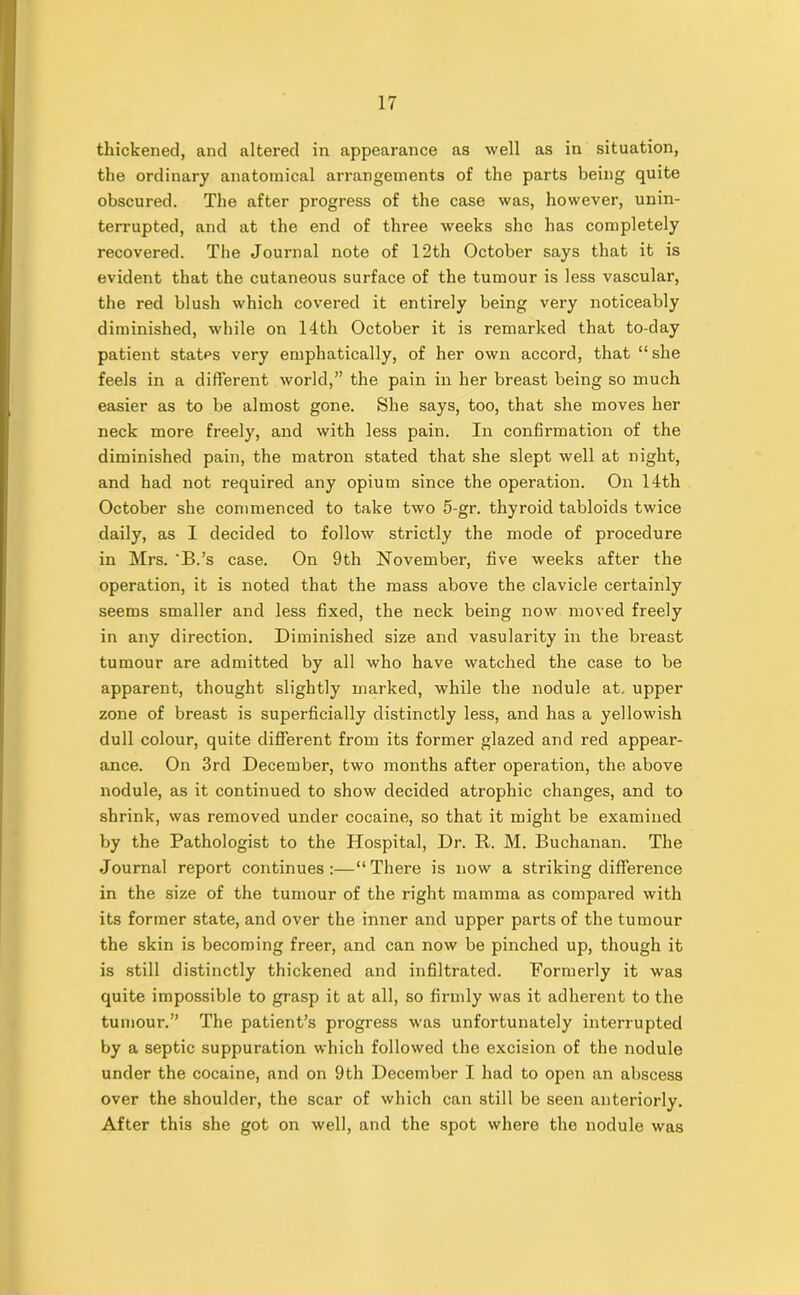 thickened, and altered in appearance as well as in situation, the ordinary anatomical arrangements of the parts being quite obscured. The after progress of the case was, however, unin- terrupted, and at the end of three weeks she has completely recovered. The Journal note of 12th October says that it is evident that the cutaneous surface of the tumour is less vascular, the red blush which covered it entirely being very noticeably diminished, while on 14th October it is remarked that to-day patient states very emphatically, of her own accord, that “she feels in a different world,” the pain in her breast being so much easier as to be almost gone. She says, too, that she moves her neck more freely, and with less pain. In confirmation of the diminished pain, the matron stated that she slept well at night, and had not required any opium since the operation. On 14th October she commenced to take two 5-gr. thyroid tabloids twice daily, as I decided to follow strictly the mode of procedure in Mrs. B.’s case. On 9th November, five weeks after the operation, it is noted that the mass above the clavicle certainly seems smaller and less fixed, the neck being now moved freely in any direction. Diminished size and vasularity in the breast tumour are admitted by all who have watched the case to be apparent, thought slightly marked, while the nodule at. upper zone of breast is superficially distinctly less, and has a yellowish dull colour, quite different from its former glazed and red appear- ance. On 3rd December, two months after operation, the above nodule, as it continued to show decided atrophic changes, and to shrink, was removed under cocaine, so that it might be examined by the Pathologist to the Hospital, Dr. It. M. Buchanan. The Journal report continues:—“There is now a striking difference in the size of the tumour of the right mamma as compared with its former state, and over the inner and upper parts of the tumour the skin is becoming freer, and can now be pinched up, though it is still distinctly thickened and infiltrated. Formerly it was quite impossible to grasp it at all, so firmly was it adherent to the tumour.” The patient’s progress was unfortunately interrupted by a septic suppuration which followed the excision of the nodule under the cocaine, and on 9th December I had to open an abscess over the shoulder, the scar of which can still be seen anteriorly. After this she got on well, and the spot where the nodule was