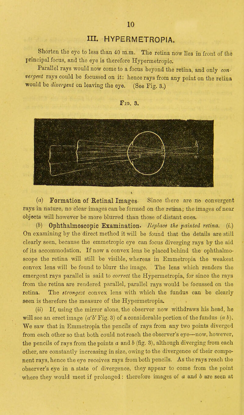 HI. HYPER METRO PI A. Shorten the eye to less than 40 m.m. The retina now lies in front of the principal focus, and tho eye is therefore Hypermetropic. Parallel rays would now come to a focus beyond the retina, and only con- vergent rays could be focussed on it: hence rays from any point on the retina would be divergent on leaving the eye. (See Fig. 3.) Fig. 3. (a) Formation of Retinal Images- Since there are no convergent rays in nature, no clear images can be formed on the retina; the images of near objects will however be more blurred than those of distant ones. (b) Ophthalmoscopic Examination* Replace the painted retina, (i.) On examining by the direct method it will be found that the details are still clearly seen, because the emmetropic eye can focus diverging rays by the aid of its accommodation. If now a convex lens be placed behind the ophthalmo- scope the retina will still be visible, whereas in Emmetropia the weakest convex lens will be found to blurr the image. The lens which renders the emergent rays parallel is said to correct the Hypermetropia, for since the rays from the retina are rendered parallel, parallel rays would be focussed on the retina, The strongest convex lens with which the fundus can be clearly seen is therefore the measure of the Hypermetropia. (ii) If, using the mirror alone, the observer now withdraws his head, he will see an erect image (a'b' Fig. 3) of a considerable portion of the fundus (a b). We saw that in Emmetropia the pencils of rays from any two points diverged from each other so that both could not reach the observer’s eye—now, however, the pencils of rays from the points a and b (fig. 3), although diverging from each other, are constantly increasing in size, owing to the divergence of their compo- nent rays, hence the eye receives rays from both pencils. As the rays reach the observer’s eye in a state of divergence, they appear to come from the point where they would meet if prolonged: therefore images of a and b are seen at