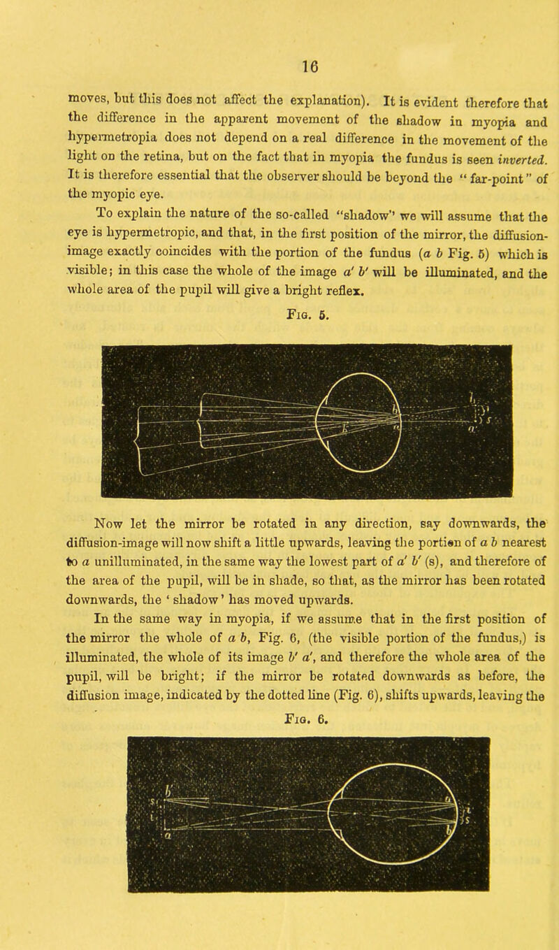 moves, but this does not affect the explanation). It is evident therefore that the difference in the apparent movement of the shadow in myopia and liypermetropia does not depend on a real difference in the movement of the light od the retina, hut on the fact that in myopia the fundus is seen inverted. It is therefore essential that the observer should be beyond the “ far-point ” of the myopic eye. To explain the nature of the so-called “shadow’’ we will assume that the eye is hypermetropic, and that, in the first position of the mirror, the diffusion- image exactly coincides with the portion of the fundus (a b Fig. 6) which is visible; in this case the whole of the image a' b' will be illuminated, and the whole area of the pupil will give a bright reflex. Fig. 5. Now let the mirror be rotated in any direction, say downwards, the diffusion-image will now shift a little upwards, leaving the portien of a b nearest to a unilluminated, in the same way the lowest part of a' V (s), and therefore of the area of the pupil, will be in shade, so that, as the mirror has been rotated downwards, the ‘ shadow ’ has moved upwards. In the same way in myopia, if we assume that in the first position of the mirror the whole of a b, Fig. 6, (the visible portion of the fundus,) is illuminated, the whole of its image V a', and therefore the whole area of the pupil, will be bright; if the mirror be rotated downwards as before, the diffusion image, indicated by the dotted line (Fig. 6), shifts upwards, leaving the Fig. 6.