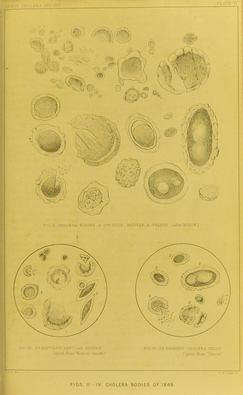 FLO.IV. D? SWAYNE'S CHOLERA CELLS Copied from. Lancet” FtG.m. Dt BRITTAN'S ANNULAR BODIES Copied from Medical Gazette FIG. II. CHOLERA BODIES of D“ BUDD. BRITT AN. & SWAYNE (alter ROBIN) J FIGS. II IV. CHOLERA BODIES OF 1849.