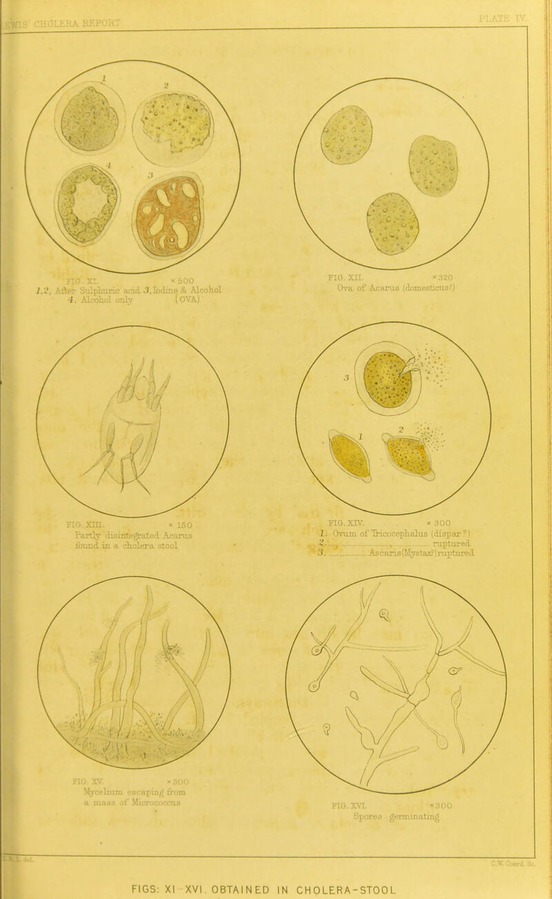 CLATE IV. ^ETTT FIGS: XI XVI. OBTAINED IN CHOLERA-STOOL •W. Coord Sc. FIG. XU. *320 Ova of Avarua (doinesticus?) FIG. XVL *300 Spores germinating FIG. XIV. * 300 li Ovum of Tricoeephalus (dispar?) ~. raptured 3. Ascaris(Mystax?) ruptured. FIG . XI. * 500 I.I’, A:V-v Sulphuric arid 3. Iodine & Alcohol -f. Alcohol only (OVA)