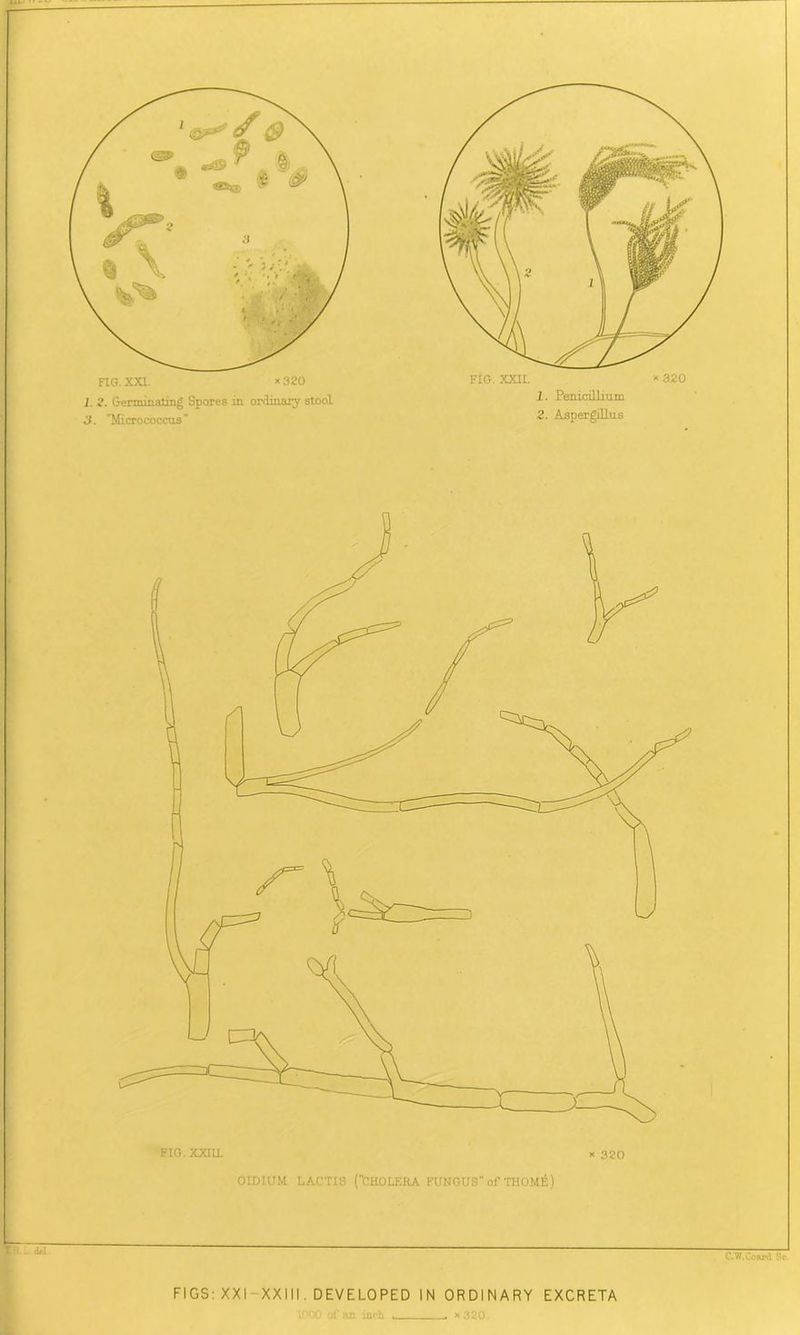 t'B .. dd FIG.XXHL x 320 OIDHJM LACTJ8 (CHOLERA FUNGUS of THOME) FIG. XXI. * 320 3. Micrococcus ■ 320 FIG. XXII. 1. Penicillium 2. Aspergillus FIGS: XXI XXIII. DEVELOPED IN ORDINARY EXCRETA 1000 of an inch , . x 320.