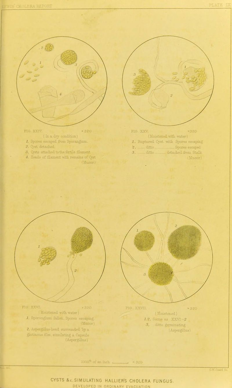 C-.'W.Coard Sr. >;• iLKHA REPuRT x 330 FIG. XXIV. x 320 (In a. diy condition) l. Spores escaped from Sporangium. S. CvBt detached 3, Cysts attached to the fertile dlament -f. Heads of filament with remains of Cyst (Mucor) 1000?! of an inch FIG. XXVII. x 320 (Moistened) 7.3. Same as XXVI -2 ■3, ditto germinating (Aspergillus) FTG. XXVI. x 320 ! Moistened with water) 1. Sporangium fallen. Spores escaping. (Mucor) 2. Aspergillus head surrounded by a glnlinous film, simulating a Capsule (Aspergillus) FIG. XXV. x320 (Moistened with water) 1. Ruptured Cyst with Spores escaping 2. ditto __ Spores escaped. 3. ditto detached from Stalk (Mucor) CYSTS &c.SIMULATING HALLIERS CHOLERA FUNGUS. DEVELOPED IN ORDINARY EVACUATION