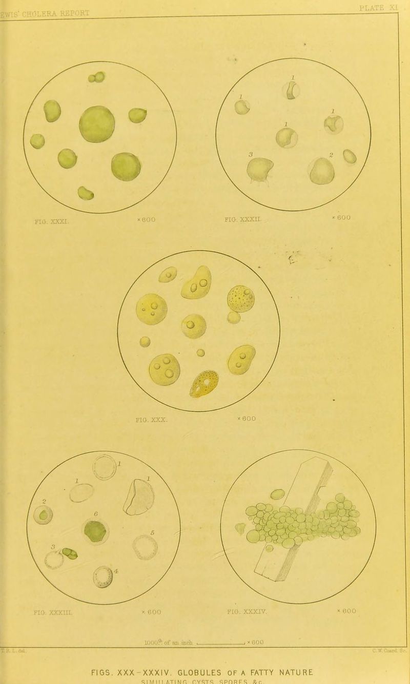 £V/:. ' H''LERA REF' 'KT FIO. XXXI. * 600 FIO. XXXII. * 600 FIG. XXX. * 600 FIG. XXX ttL * 600 FIG. XXXIV. * 600 LUOUp of an inch , *600 X R-L.daL. C.W. Coard Sc. FIGS. XXX - XXXIV. GLOBULES OF A FATTY NATURE SIMIIIATINR O.YRTR RPDRFS X-r.