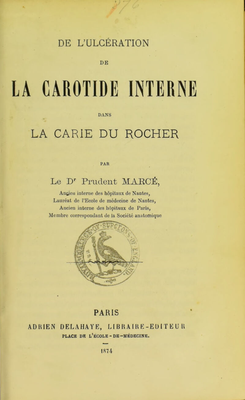 DE L’ULCERATION LA CAROTIDE INTERNE DANS LA CARIE DU ROCHER PAR Le Dr Prudent MARCÉ, Ancien interne des hôpitaux de Nantes, Lauréat de l’Ecole de médecine de Nantes, Ancien interne des hôpitaux de Paris, Membre correspondant de la Société anatomique ADBIEN DELAHAYE, LI BH A IB E-ED i T E U U PLACE DR L’ECOLE - DE-MÉDECINE.