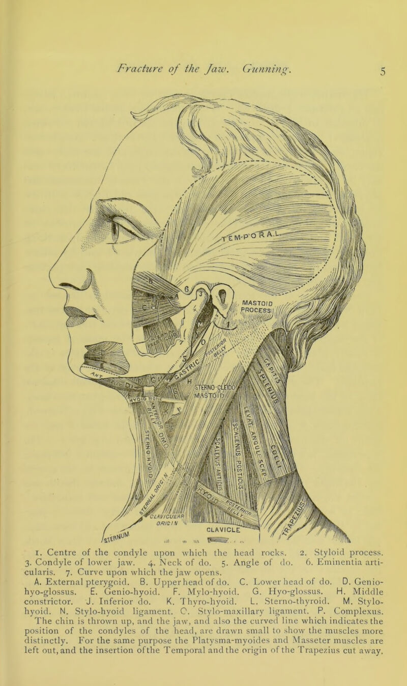 i. Centre of the condyle upon which the head rocks. 2. Styloid process. 3. Condyle of lower jaw. 4. Neck of do. 5. Angle of do. 6. Eminentia arti- cularis. 7. Curve upon which the jaw opens. A. External pterygoid. B. Upperhead of do. C. Lower head of do. D. Genio- hyo-glossus. E. Genio-hyoid. F. Mylo-hyoid. G. Hyo-glossus. H. Middle constrictor. J. Inferior do. K. Thyro-hyoid. L. Sterno-thyroid. M. Stylo- hyoid. N. Stylo-hyoid ligament. C. Stylo-maxillary ligament. P. Complexus. The chin is thrown up, and the jaw, and also the curved line which indicates the position of the condyles of the head, are drawn small to show the muscles more distinctly. For the same purpose the Platysma-myoides and Masseter muscles are left out, and the insertion ofthe Temporal and the origin of the Trapezius cut away.