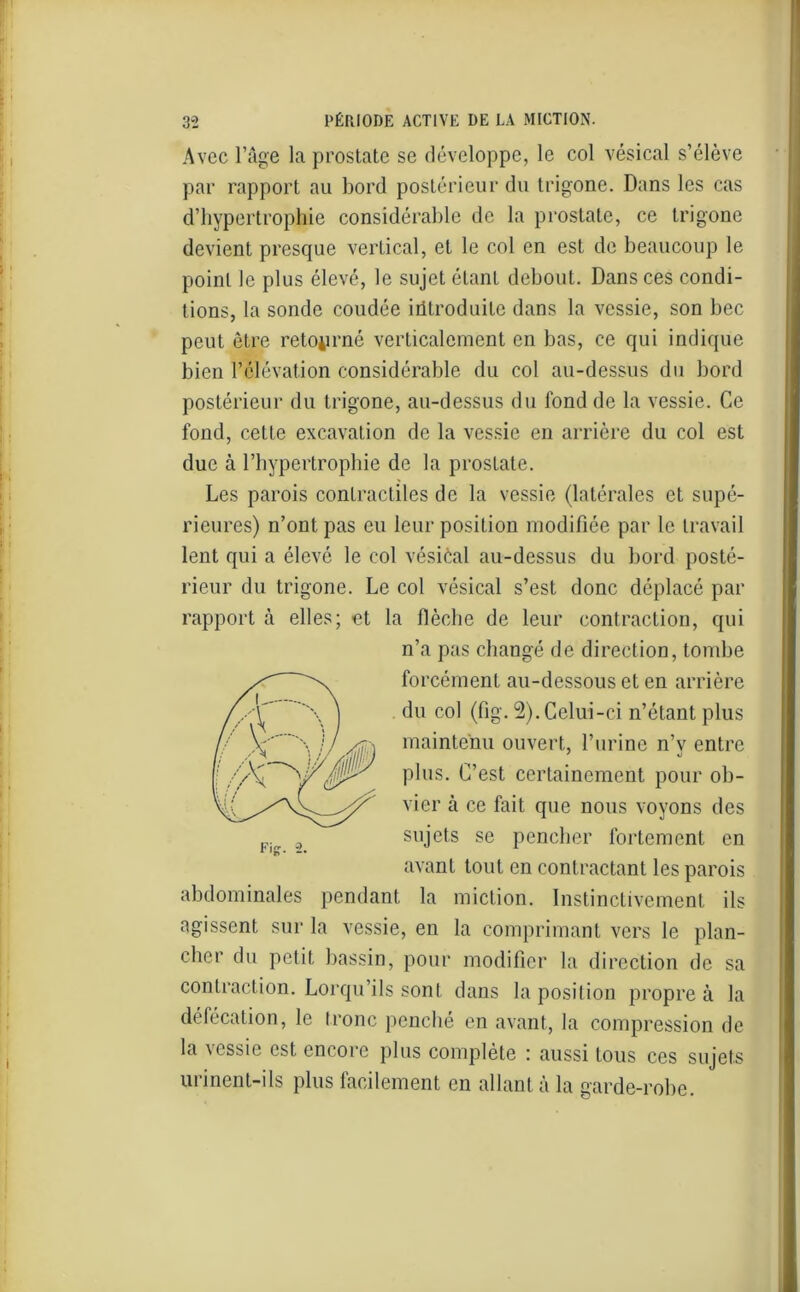 Avec l’âge la prostate se développe, le col vésical s’élève par rapport au bord postérieur du trigone. Dans les cas d’hypertrophie considérable de la prostate, ce trigone devient presque vertical, et le col en est de beaucoup le point le plus élevé, le sujet étant debout. Dans ces condi- tions, la sonde coudée iütroduile dans la vessie, son bec peut être retourné verticalement en bas, ce qui indique bien l’élévation considérable du col au-dessus du bord postérieur du trigone, au-dessus du fond de la vessie. Ce fond, cette excavation de la vessie en arrière du col est duc à l’hypertrophie de la prostate. Les parois contractiles de la vessie (latérales et supé- rieures) n’ont pas eu leur position modifiée par le travail lent qui a élevé le col vésical au-dessus du bord posté- rieur du trigone. Le col vésical s’est donc déplacé par rapport à elles; et la flèche de leur contraction, qui n’a pas changé de direction, tombe forcément au-dessous et en arrière du col (fig. 2). Celui-ci n’étant plus maintenu ouvert, l’urine n’v entre plus. C’est certainement pour ob- vier à ce fait que nous voyons des sujets se pencher fortement en avant tout en contractant les parois abdominales pendant la miction. Instinctivement ils agissent sur la vessie, en la comprimant vers le plan- cher du petit bassin, pour modifier la direction de sa contraction. Lorqu’ils sont dans la position propre à la défécation, le tronc penché en avant, la compression de la vessie est encore plus complète : aussi tous ces sujets urinent-ils plus facilement en allant à la garde-robe