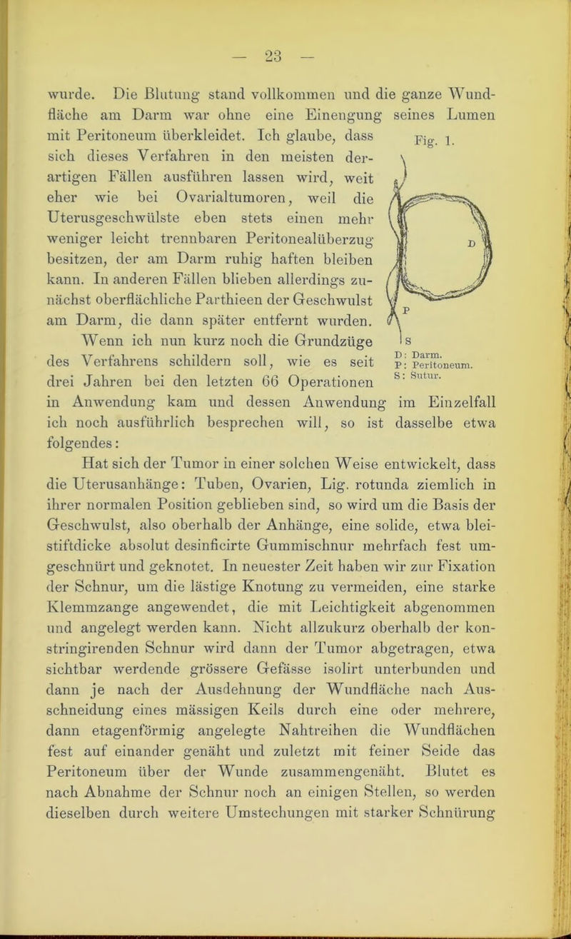 wurde. Die Blutung stand vollkommen und die ganze Wund- fläche am Dann war ohne eine Einengung seines Lumen mit Peritoneum überkleidet. Ich glaube, dass sich dieses Verfahren in den meisten der- artigen Fällen ausführen lassen wird, weit eher wie bei Ovarialtumoren, weil die Uterusgeschwülste eben stets einen mehr weniger leicht trennbaren Peritonealüberzug besitzen, der am Darm ruhig haften bleiben kann. In anderen Fällen blieben allerdings zu- nächst oberflächliche Parthieen der Geschwulst am Darm, die dann später entfernt wurden. Wenn ich nun kurz noch die Grundzüge des Verfahrens schildern soll, wie es seit drei Jahren bei den letzten G6 Operationen in Anwendung kam und dessen Anwendung im Einzelfall ich noch ausführlich besprechen will, so ist dasselbe etwa folgendes: Hat sich der Tumor in einer solchen Weise entwickelt, dass die Uterusanhänge: Tuben, Ovarien, Lig. rotunda ziemlich in ihrer normalen Position geblieben sind, so wird um die Basis der Geschwulst, also oberhalb der Anhänge, eine solide, etwa blei- stiftdicke absolut desinficirte Gummischnur mehrfach fest um- geschnürt und geknotet. In neuester Zeit haben wir zur Fixation der Schnur, um die lästige Knotung zu vermeiden, eine starke Klemmzange angewendet, die mit Leichtigkeit abgenommen und angelegt werden kann. Nicht allzukurz oberhalb der kon- stringirenden Schnur wird dann der Tumor abgetragen, etwa sichtbar werdende grössere Gefässe isolirt unterbunden und dann je nach der Ausdehnung der Wundfläche nach Aus- schneidung eines mässigen Keils durch eine oder mehrere, dann etagenförmig angelegte Nahtreihen die Wundflächen fest auf einander genäht und zuletzt mit feiner Seide das Peritoneum über der Wunde zusammengenäht. Blutet es nach Abnahme der Schnur noch an einigen Stellen, so werden dieselben durch weitere Umstechungen mit starker Schnürung Fig. 1. D: Darm. P: Peritoneum. S: Sutur.