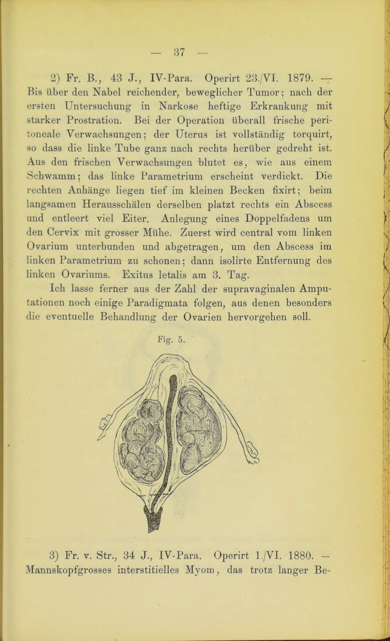 Bis über den Nabel reichender, beweglicher Tumor; nach der ersten Untersuchung in Narkose heftige Erkrankung mit starker Prostration. Bei der Operation überall frische peri- toneale Verwachsungen; der Uterus ist vollständig torquirt, so dass die linke Tube ganz nach rechts herüber gedreht ist. Aus den frischen Verwachsungen blutet es, -wie aus einem Schwamm; das linke Parametrium erscheint verdickt. Die rechten Anhänge liegen tief im kleinen Becken fixirt; beim langsamen Herausschälen derselben platzt rechts ein Abscess und entleert viel Eiter. Anlegung eines Doppelfadens um den Cervix mit grosser Mühe. Zuerst wird central vom linken Ovarium unterbunden und abgetragen, um den Abscess im linken Parametrium zu schonen; dann isolirte Entfernung des linken Ovariums. Exitus letalis am 3. Tag. Ich lasse ferner aus der Zahl der supravaginalen Ampu- tationen noch einige Paradigmata folgen, aus denen besonders die eventuelle Behandlung der Ovarien hervorgehen soll. Fig. 5. 3) Fr. v. Str., 34 J., IV-Para. Operirt 1 /VI. 1880. — Mannskopfgrosses interstitielles Myom, das trotz langer Be-