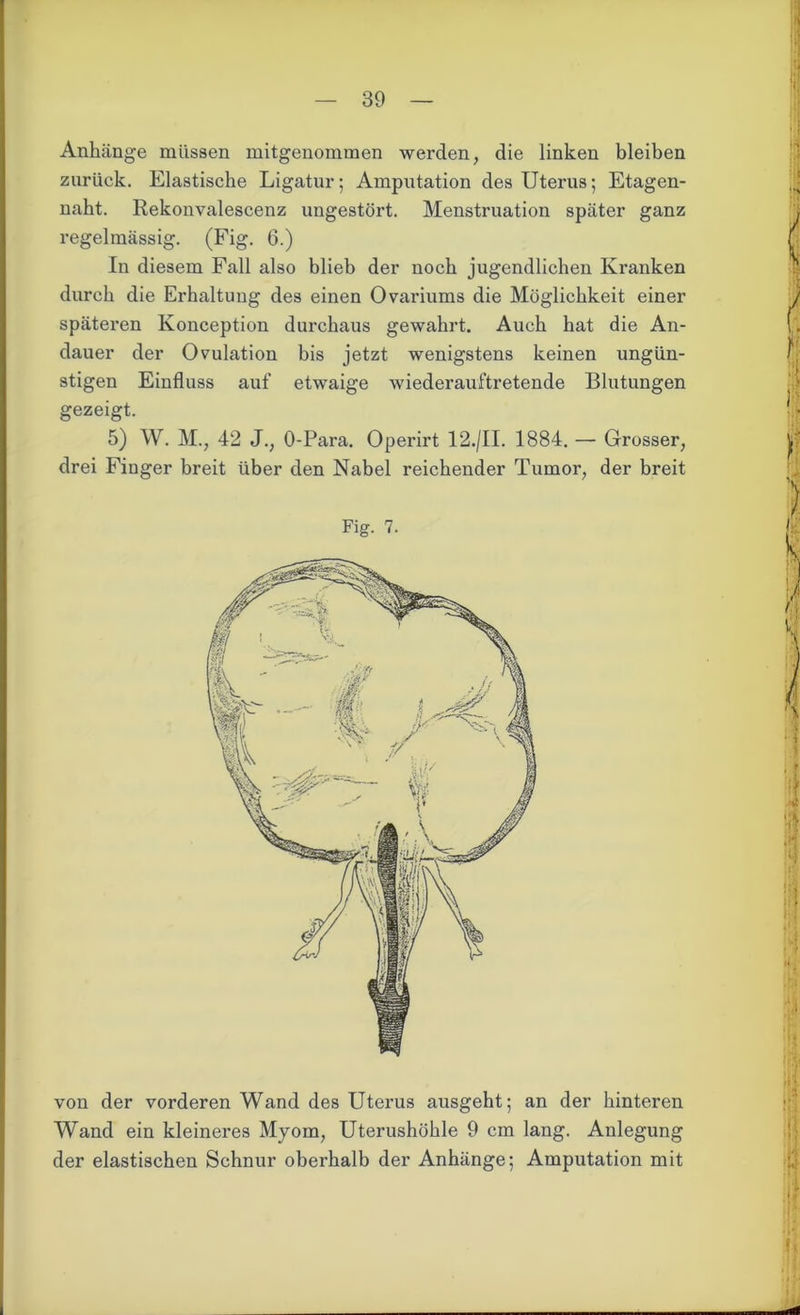 Anhänge müssen mitgenommen werden, die linken bleiben zurück. Elastische Ligatur; Amputation des Uterus; Etagen- naht. Rekonvalescenz ungestört. Menstruation später ganz regelmässig. (Fig. 6.) In diesem Fall also blieb der noch jugendlichen Kranken durch die Erhaltung des einen Ovariums die Möglichkeit einer späteren Ivonception durchaus gewahrt. Auch hat die An- dauer der Ovulation bis jetzt wenigstens keinen ungün- stigen Einfluss auf etwaige wiederauftretende Blutungen gezeigt. 5) W. M., 42 J., O-Para. Operirt 12./II. 1884. — Grosser, drei Finger breit über den Nabel reichender Tumor, der breit Fig. 7. von der vorderen Wand des Uterus ausgeht; an der hinteren Wand ein kleineres Myom, Uterushöhle 9 cm lang. Anlegung der elastischen Schnur oberhalb der Anhänge; Amputation mit