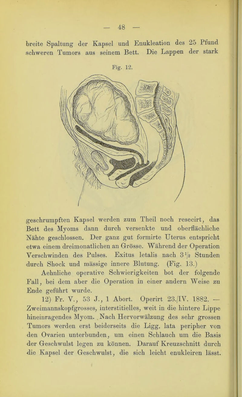 breite Spaltung der Kapsel und Enukleation des 25 Pfund schweren Tumors aus seinem Bett. Die Lappen der stark Fig. 12. geschrumpften Kapsel werden zum Theil noch resecirt, das Bett des Myoms dann durch versenkte und oberflächliche Nähte geschlossen. Der ganz gut formirte Uterus entspricht etwa einem dreimonatlichen an Grösse. Während der Operation Verschwinden des Pulses. Exitus letalis nach 3x/2 Stunden durch Shock und mässige innere Blutung. (Fig. 13.) Aehnliche operative Schwierigkeiten bot der folgende Fall, bei dem aber die Operation in einer andern Weise zu Ende geführt wurde. 12) Fr. V., 53 J., 1 Abort. Operirt 23./IV. 1882. — Zweimannskopfgrosses, interstitielles, weit in die hintere Lippe hineinragendes Myom. . Nach Hervorwälzung des sehr grossen Tumors werden erst beiderseits die Ligg. lata peripher von den Ovarien unterbunden, um einen Schlauch um die Basis der Geschwulst legen zu können. Darauf Kreuzschnitt durch •die Kapsel der Geschwulst, die sich leicht enukleiren lässt.