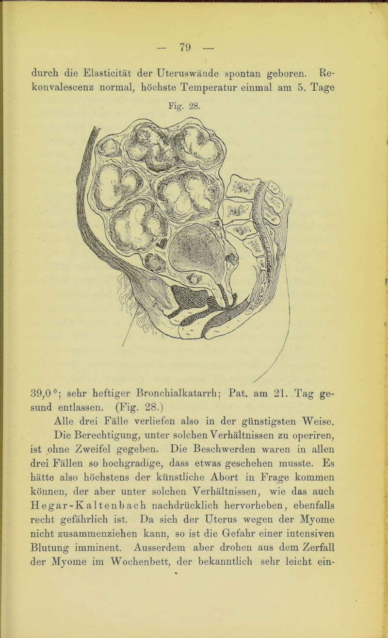 durch die Elasticität der Uteruswände spontan geboren. Re- kouvalescenz normal, höchste Temperatur einmal am 5. Tage Fig. 28. 39,0°; sehr heftiger Bronchialkatarrh; Pat. am 21. Tag ge- sund entlassen. (Fig. 28.) Alle drei Fälle verliefen also in der günstigsten Weise. Die Berechtigung, unter solchen Verhältnissen zu operiren, ist ohne Zweifel gegeben. Die Beschwerden waren in allen drei Fällen so hochgradige, dass etwas geschehen musste. Es hätte also höchstens der künstliche Abort in Frage kommen können, der aber unter solchen Verhältnissen, wie das auch Hegar-Kaltenbach nachdrücklich hervorheben, ebenfalls recht gefährlich ist. Da sich der Uterus wegen der Myome nicht zusammenziehen kann, so ist die Gefahr einer intensiven Blutung imminent. Ausserdem aber drohen aus dem Zerfall der Myome im Wochenbett, der bekanntlich sehr leicht ein-