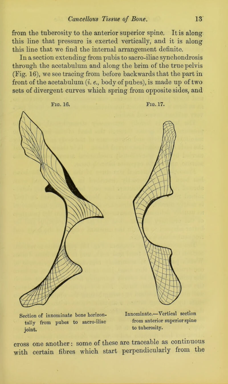 from the tuberosity to the anterior superior spine. It is along this line that pressure is exerted vertically, and it is along this line that we find the internal arrangement definite. In a section extending from pubis to sacro-iliac synchondrosis through the acetabulum and along the brim of the true pelvis (Fig. 16), we see tracing from before backwards that the part in front of the acetabulum (i. e., body of pubes), is made up of two sets of divergent curves which spring from opposite sides, and Fig. 16. Section of innominate bone horizon- tally from pubes to sacro-iliac joint. Fig. 17. Innominate.—Vertical section from anterior superior spine to tuberosity. cross one another: some of these are traceable as continuous with certain fibres which start perpendicularly fiom the