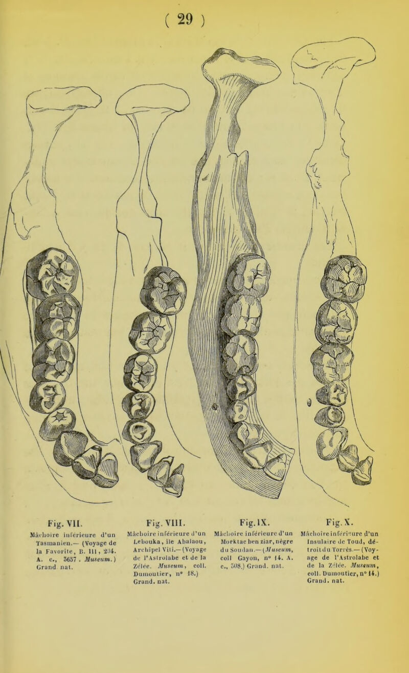 Fig. VU. Mâchoire inférieure d’un Tosinanieu.— (Voyage de la Favorite, U. lit, 204. A. e., 3657. Muséum.) Grand nal. Fig. VIII. Mâchoire inférieure d’un Lebouka, ile Abalaou, Archipel VUi.— (Voyage de l'Astrolabe et de In Zélée. Muséum, col I. Dumoutier, n® 18.) Grand, nat. Fig. IX. Mâchoire inférieure d’un Morktac ben ziar, nègre du Soudan.— (.Muséum, coll Gayon, n° 14. A. c., 308,) Grand, nat. Fig- X. Mâchoire inférieure d’un Insulaire de Toud, dé- troit d u Torrès — ( Voy - nge de l’Astrolabe et de la 7/*léc. Muséum, coll. Dumoutier, n° 14.) Grand, nat.