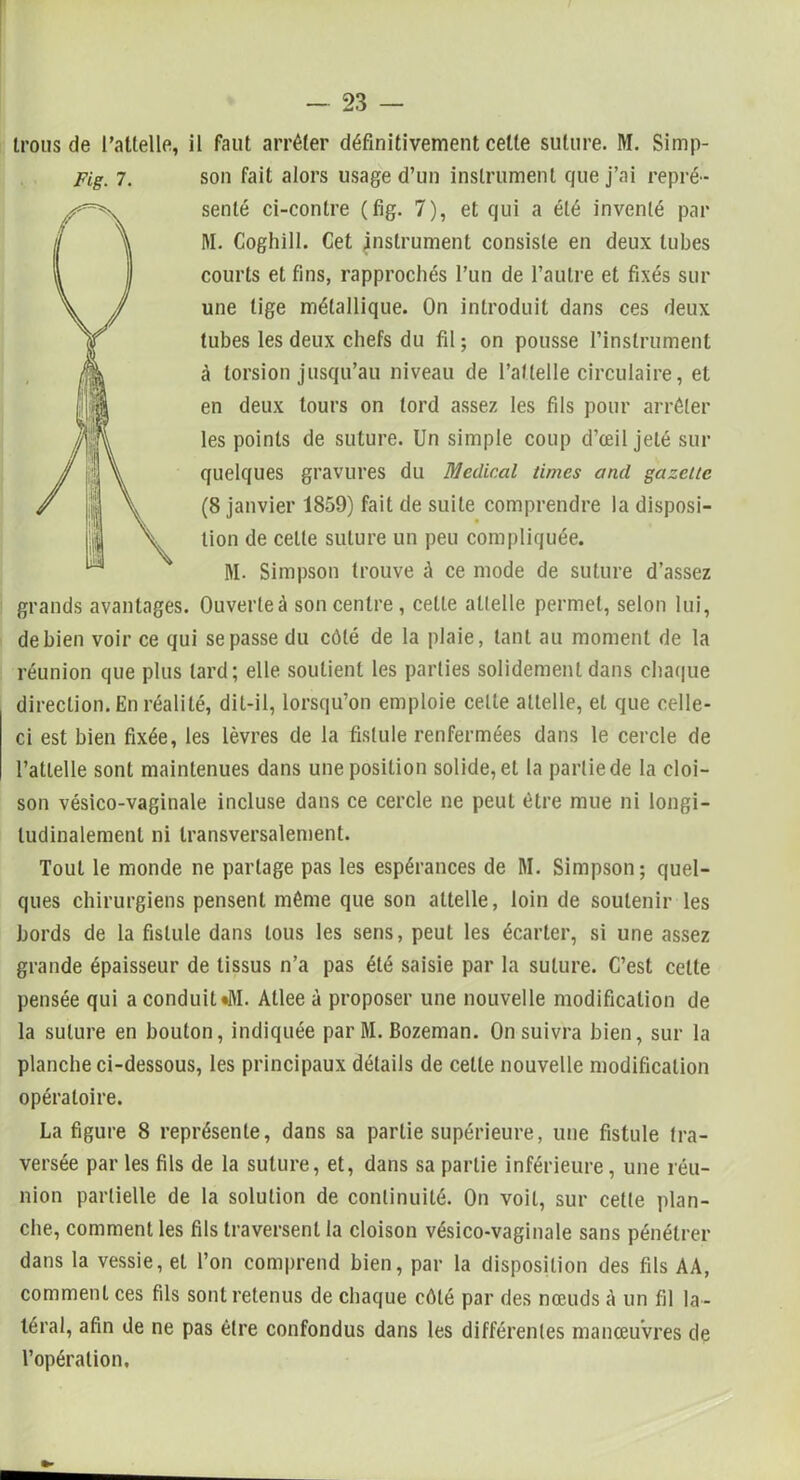 Irons de l’attelle, il Faut arrêter définitivement celte suture. M. Simp- Fig. 7. son fait alors usage d’un instrument que j’ai repré- senté ci-contre (fig. 7), et qui a été inventé par M. Coghill. Cet instrument consiste en deux tubes courts et fins, rapprochés l’un de l’autre et fixés sur une tige métallique. On introduit dans ces deux tubes les deux chefs du fil; on pousse l’instrument à torsion jusqu’au niveau de l’attelle circulaire, et en deux tours on tord assez les fils pour arrêter les points de suture. Un simple coup d’œil jeté sur quelques gravures du Medical times and gazelle (8 janvier 1859) fait de suite comprendre la disposi- tion de celle suture un peu compliquée. M. Simpson trouve à ce mode de suture d’assez grands avantages. Ouverteà son centre, cette attelle permet, selon lui, de bien voir ce qui se passe du côté de la plaie, tant au moment de la réunion que plus lard; elle soutient les parties solidement dans chaque direction. En réalité, dit-il, lorsqu’on emploie celte attelle, et que celle- ci est bien fixée, les lèvres de la fistule renfermées dans le cercle de l’attelle sont maintenues dans une position solide, et la partie de la cloi- son vésico-vaginale incluse dans ce cercle ne peut être mue ni longi- tudinalement ni transversalement. Tout le monde ne partage pas les espérances de M. Simpson; quel- ques chirurgiens pensent même que son attelle, loin de soutenir les bords de la fistule dans tous les sens, peut les écarter, si une assez grande épaisseur de tissus n’a pas été saisie par la suture. C’est celte pensée qui a conduit «M. Atlee à proposer une nouvelle modification de la suture en bouton, indiquée par M. Bozeman. On suivra bien, sur la planche ci-dessous, les principaux détails de celte nouvelle modification opératoire. La figure 8 représente, dans sa partie supérieure, une fistule tra- versée par les fils de la suture, et, dans sa partie inférieure, une réu- nion partielle de la solution de continuité. On voit, sur cette plan- che, comment les fils traversent la cloison vésico-vaginale sans pénétrer dans la vessie, et l’on comprend bien, par la disposition des fils AA, comment ces fils sont retenus de chaque côté par des nœuds A un fil la- téral, afin de ne pas être confondus dans les différentes manœuvres de l’opération.