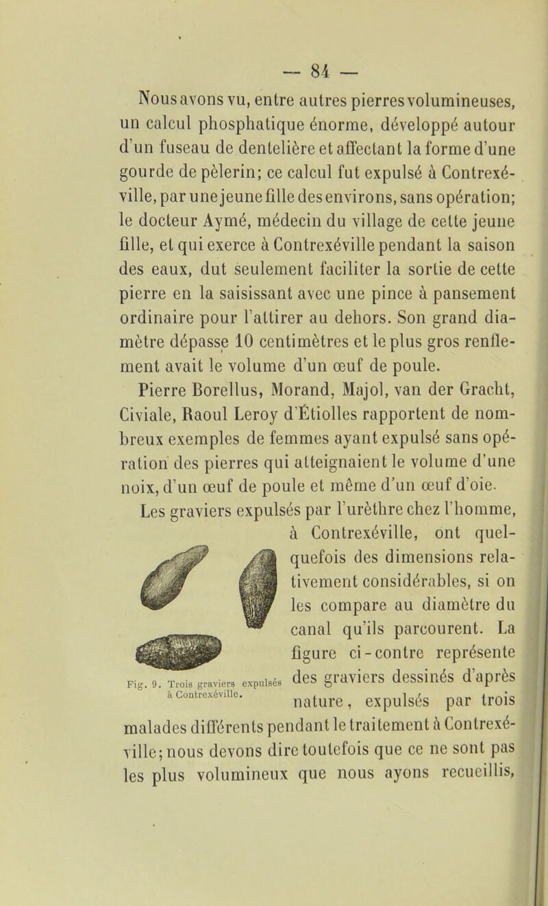 Nous avons vu, entre autres pierres volumineuses, un calcul phosphatique énorme, développé autour d’un fuseau de dentelière et affectant la forme d’une gourde de pèlerin; ce calcul fut expulsé à Contrexé- ville, par une jeune fille desenvirons, sans opération; le docteur Aymé, médecin du village de celte jeune fille, et qui exerce à Contrexéville pendant la saison des eaux, dut seulement faciliter la sortie de cette pierre en la saisissant avec une pince à pansement ordinaire pour l’attirer au dehors. Son grand dia- mètre dépasse 10 centimètres et le plus gros renfle- ment avait le volume d’un œuf de poule. Pierre Borellus, Morand, Majol, van der Gracht, Civiale, Raoul Leroy d’Étiolles rapportent de nom- breux exemples de femmes ayant expulsé sans opé- ration des pierres qui atteignaient le volume d’une noix, d’un œuf de poule et même d’un œuf d'oie. Les graviers expulsés par l’urèthre chez l'homme, à Contrexéville, ont quel- quefois des dimensions rela- tivement considérables, si on les compare au diamètre du canal qu’ils parcourent. La figure ci-contre représente des graviers dessinés d'après nature, expulsés par trois malades différents pendant le trai tement à Contrexé- ville; nous devons dire toutefois que ce ne sont pas les plus volumineux que nous ayons recueillis, Fig. 9. Trois graviers expulsés ù Contrexéville.