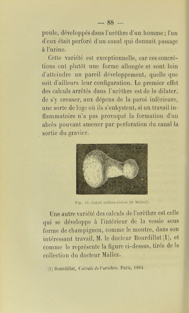poule, développés dans l’urèthre d’un homme ; l’un d’eux était perforé d’un canal qui donnait passage à l’urine. Cette variété est exceptionnelle, car ces concré- tions ont plutôt une forme allongée et sont loin d'atteindre un pareil développement, quelle que soit d’ailleurs leur configuration. Le premier effet des calculs arrêtés dans l’urèthre est de le dilater, de s’y creuser, aux dépens de la paroi inférieure, une sorte de loge où ils s’enkystent, si un travail in- flammatoire n’a pas provoqué la formation d’un abcès pouvant amener par perforation du canal la sortie du gravier. Fig'. 13. Calcul uréthro-vésical (Dr Mallez',1. Une autre variété des calculs de 1 urèthre est celle qui se développe à l’intérieur de la vessie sous forme de champignon, comme le montre, dans son intéressant travail, M. le docteur Bourdillat (1), et comme le représente la figure ci-dessus, tirée de la collection du docteur Mallez. (1) Bourdillat, Calculs de l’urèlhre. Paris, 1864.