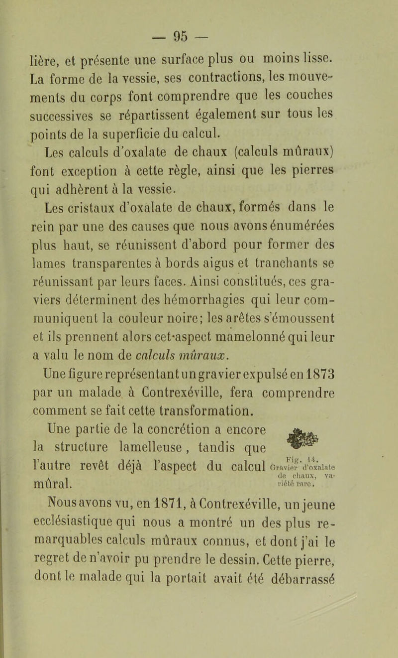 lière, et présente une surface plus ou moins lisse. La forme de la vessie, ses contractions, les mouve- ments du corps font comprendre que les couches successives se répartissent également sur tous les points de la superficie du calcul. Les calculs d’oxalate de chaux (calculs muraux) font exception à cette règle, ainsi que les pierres qui adhèrent à la vessie. Les cristaux d’oxalate de chaux, formés dans le rein par une des causes que nous avons énumérées plus haut, se réunissent d’abord pour former des lames transparentes à bords aigus et tranchants se réunissant par leurs faces. Ainsi constitués, ces gra- viers déterminent des hémorrhagies qui leur com- muniquent la couleur noire; les arêtes s’émoussent et ils prennent alors cebaspect mamelonné qui leur a valu le nom de calculs mûraux. Une figure représentant un gravier expulsé en 1873 par un malade à Contrexéville, fera comprendre comment se fait cette transformation. Une partie de la concrétion a encore la structure lamelleuse, tandis que l’autre revêt déjà l’aspect du calcul Gravier il'oxalnte v de chaux, va- m lirai. riété rare. Nous avons vu, en 1871, à Contrexéville, un jeune ecclésiastique qui nous a montré un des plus re- marquables calculs mûraux connus, et dont j’ai le regret de n’avoir pu prendre le dessin. Cette pierre, dont le malade qui la portait avait, été débarrassé