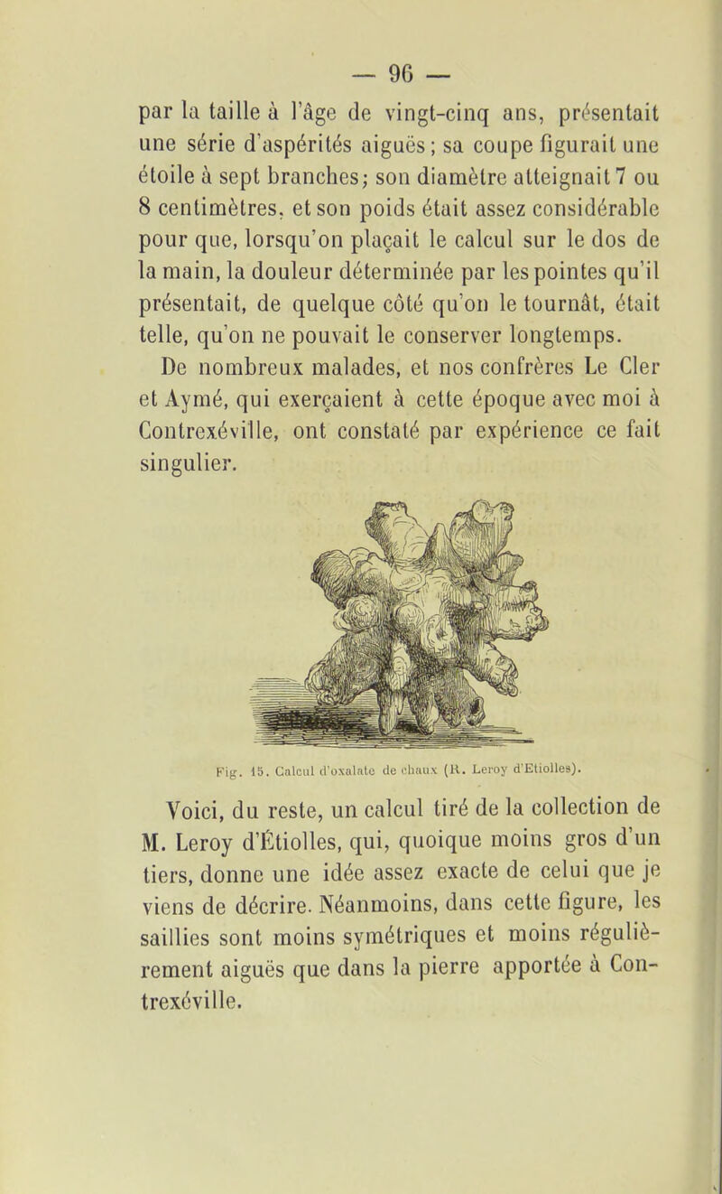 — 90 — par la taille à l’âge de vingt-cinq ans, présentait une série d'aspérités aiguës; sa coupe figurait une étoile à sept branches ; son diamètre atteignait 7 ou 8 centimètres, et son poids était assez considérable pour que, lorsqu’on plaçait le calcul sur le dos de la main, la douleur déterminée par les pointes qu’il présentait, de quelque côté qu’on le tournât, était telle, qu’on ne pouvait le conserver longtemps. De nombreux malades, et nos confrères Le Cler et Aymé, qui exerçaient à cette époque avec moi à Contrexéville, ont constaté par expérience ce fait singulier. Fig. 15. Calcul d’oxalate de chaux (H. Leroy d’Etiolles). Voici, du reste, un calcul tiré de la collection de M. Leroy d’Étiolles, qui, quoique moins gros d’un tiers, donne une idée assez exacte de celui que je viens de décrire. Néanmoins, dans cette figure, les saillies sont moins symétriques et moins réguliè- rement aiguës que dans la pierre apportée à Con- trexéville.