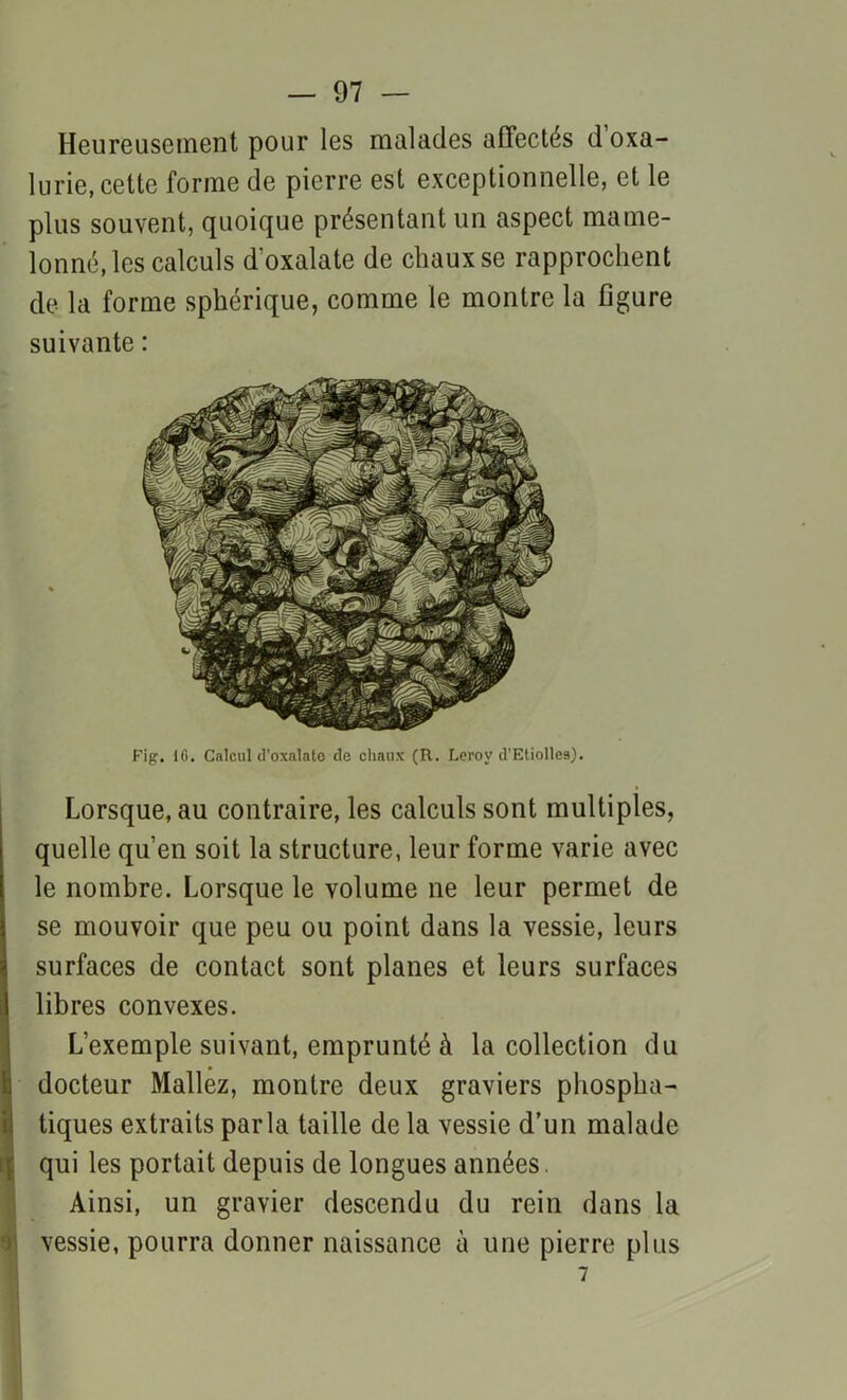 Heureusement pour les malades affectés doxa- lurie, cette forme de pierre est exceptionnelle, et le plus souvent, quoique présentant un aspect mame- lonné, les calculs d'oxalate de chaux se rapprochent de la forme sphérique, comme le montre la figure suivante : Fig. IG. Calcul d'oxalate de chaux (R. Leroy d’Etiolle9). Lorsque, au contraire, les calculs sont multiples, quelle qu’en soit la structure, leur forme varie avec le nombre. Lorsque le volume ne leur permet de se mouvoir que peu ou point dans la vessie, leurs surfaces de contact sont planes et leurs surfaces libres convexes. L’exemple suivant, emprunté à la collection du docteur Mallez, montre deux graviers phospha- tiques extraits parla taille de la vessie d’un malade qui les portait depuis de longues années. Ainsi, un gravier descendu du rein dans la vessie, pourra donner naissance à une pierre plus 7