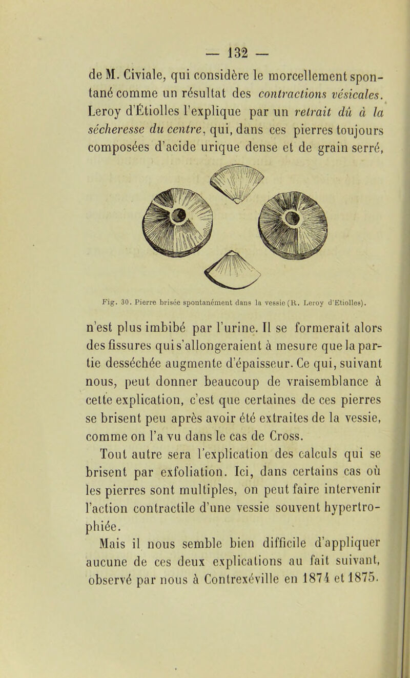 de M. Civiale, qui considère le morcellement spon- tané comme un résultat des contractions vésicales. Leroy d’Étiolles l’explique par un retrait dû à la sécheresse du centre, qui, dans ces pierres toujours composées d’acide urique dense et de grain serré, Fig. 30. Pierre brisée spontanément dans la vessie (R. Leroy d’Etiolles). n’est plus imbibé par l’urine. 11 se formerait alors des fissures quis’allongeraient à mesure que la par- tie desséchée augmente d’épaisseur. Ce qui, suivant nous, peut donner beaucoup de vraisemblance à cette explication, c’est que certaines de ces pierres se brisent peu après avoir été extraites de la vessie, comme on l’a vu dans le cas de Cross. Tout autre sera l’explication des calculs qui se brisent par exfoliation. Ici, dans certains cas où les pierres sont multiples, on peut faire intervenir l’action contractile d’une vessie souvent hypertro- phiée. Mais il nous semble bien difficile d’appliquer aucune de ces deux explications au fait suivant, observé par nous à Contrexéville en 1874 et 1875.