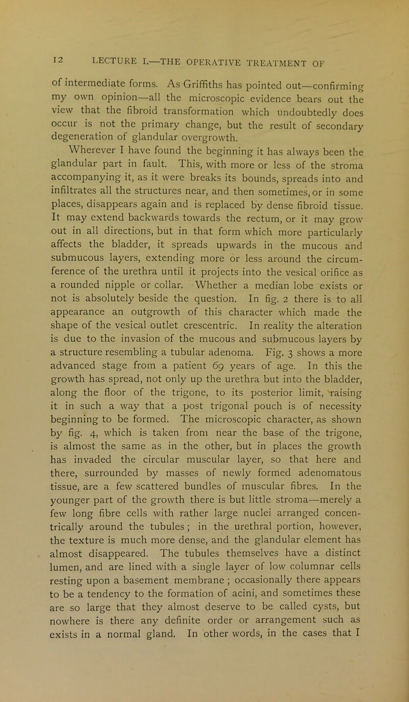 of intermediate forms. As Griffiths has pointed out—confirming my own opinion—all the microscopic evidence bears out the view that the fibroid transformation which undoubtedly does occur is not the primary change, but the result of secondary degeneration of glandular overgrowth. Wherever I have found the beginning it has always been the glandular part in fault. This, with more or less of the stroma accompanying it, as it were breaks its bounds, spreads into and infiltrates all the structures near, and then sometimes, or in some places, disappears again and is replaced by dense fibroid tissue. It may extend backwards towards the rectum, or it may grow out in all directions, but in that form which more particularly affects the bladder, it spreads upwards in the mucous and submucous layers, extending more or less around the circum- ference of the urethra until it projects into the vesical orifice as a rounded nipple or collar. Whether a median lobe exists or not is absolutely beside the question. In fig. 2 there is to all appearance an outgrowth of this character which made the shape of the vesical outlet crescentric. In reality the alteration is due to the invasion of the mucous and submucous layers by a structure resembling a tubular adenoma. Fig. 3 shows a more advanced stage from a patient 69 years of age. In this the growth has spread, not only up the urethra but into the bladder, along the floor of the trigone, to its posterior limit, raising it in such a way that a post trigonal pouch is of necessity beginning to be formed. The microscopic character, as shown by fig. 4, which is taken from near the base of the trigone, is almost the same as in the other, but in places the growth has invaded the circular muscular layer, so that here and there, surrounded by masses of newly formed adenomatous tissue, are a few scattered bundles of muscular fibres. In the younger part of the growth there is but little stroma—merely a few long fibre cells with rather large nuclei arranged concen- trically around the tubules ; in the urethral portion, however, the texture is much more dense, and the glandular element has almost disappeared. The tubules themselves have a distinct lumen, and are lined with a single layer of low columnar cells resting upon a basement membrane; occasionally there appears to be a tendency to the formation of acini, and sometimes these are so large that they almost deserve to be called cysts, but nowhere is there any definite order or arrangement such as exists in a normal gland. In other words, in the cases that I