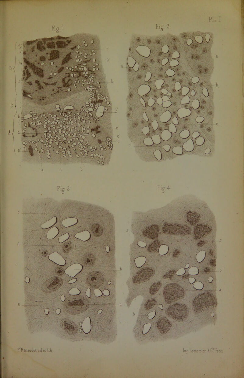 Fig.4- fFenaudot del et lith lmp Lemercier & C'e Pans