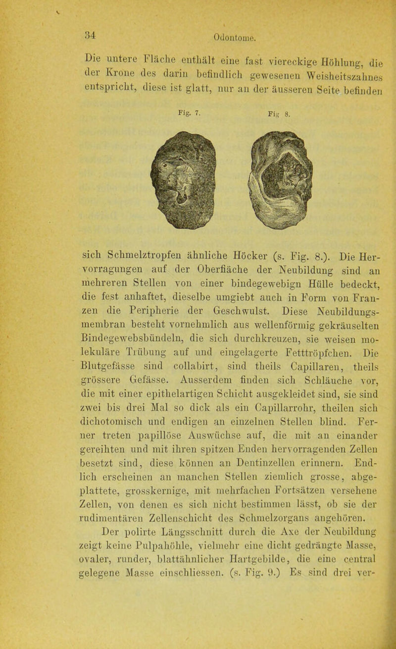 Die untere Mache enthält eine fast viereckige Höhlung, die der Krone des darin befindlich gewesenen Weisheitszahnes entspricht, diese ist glatt, nur an der äusseren Seite befinden Fig. 7. Fig 8. sich Schmelztropfen ähnliche Höcker (s. Fig. 8.). Die Her- vorragungen auf der Oberfläche der Neubildung sind an mehreren Stellen von einer bindegewebign Hölle bedeckt, die fest anhaftet, dieselbe umgiebt auch in Form von Frau- zen die Peripherie der Geschwulst. Diese Neubildungs- membran besteht vornehmlich aus wellenförmig gekräuselten Bindegewebsbündeln, die sich durchkreuzen, sie weisen mo- lekuläre Trübung auf und eingelagerte Fetttröpfchen. Die Blutgefässe sind collabirt, sind theils Capillaren, theils grössere Gefässe. Ausserdem finden sich Schläuche vor, die mit einer epithelartigen Schicht ausgekleidet sind, sie sind zwei bis drei Mal so dick als ein Capillarrohr, theilen sich dichotomisch und endigen an einzelnen Stellen blind. Fer- ner treten papillöse Auswüchse auf, die mit an einander gereihten und mit ihren spitzen Enden hervorragenden Zellen besetzt sind, diese können an Dentinzellen erinnern. End- lich erscheinen an manchen Stellen ziemlich grosse, abge- plattete, grosskernige, mit mehrfachen Fortsätzen versehene Zellen, von denen es sich nicht bestimmen lässt, ob sie der rudimentären Zellenschicht des Schmelzorgans angehören. Der polirte Längsschnitt durch die Axe der Neubildung zeigt keine Pulpahöhle, vielmehr eine dicht gedrängte Masse, ovaler, runder, blattähnlicher Hartgebilde, die eine central gelegene Masse einschliessen. (s. Fig. 9.) Es sind drei ver-