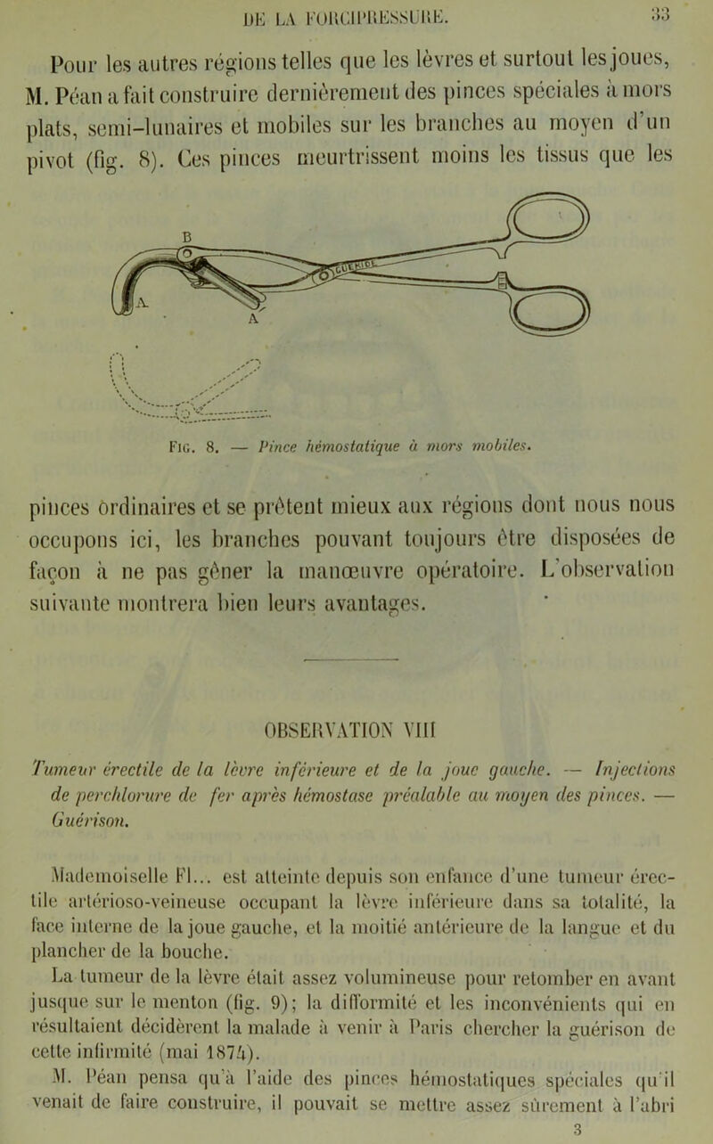 Pour les autres régions telles que les lèvres et surtout les joues, M. Péan a fait construire dernièrement des pinces spéciales à mors plats, semi-lunaires et mobiles sur les branches au moyen d un pivot (fig. 8). Ces pinces meurtrissent moins les tissus que les Fig. 8. — Pince hémostatique à mors mobiles. pinces ordinaires et se prêtent mieux aux régions dont nous nous occupons ici, les branches pouvant toujours être disposées de façon à ne pas gêner la manœuvre opératoire. L’observation suivante montrera bien leurs avantages. OBSERVATION VIII Tumeur érectile île la l'erre inférieure et de la joue gauche. — Injections de perchlorure de fer après hémostase préalable au moyen des pinces. — Guérison. Mademoiselle Fl... est atteinte depuis son enfance d’une tumeur érec- tile arlérioso-veineuse occupant la lèvre inférieure dans sa totalité, la face interne de la joue gauche, et la moitié antérieure de la langue et du plancher de la bouche. La tumeur de la lèvre était assez volumineuse pour retomber en avant jusque sur le menton (fig. 9); la difformité et les inconvénients qui en résultaient décidèrent la malade à venir à Paris chercher la guérison de cette infirmité (mai 1874). M. Péan pensa quà l’aide des pinces hémostatiques spéciales qu'il venait de faire construire, il pouvait se mettre assez sûrement à l’abri 3
