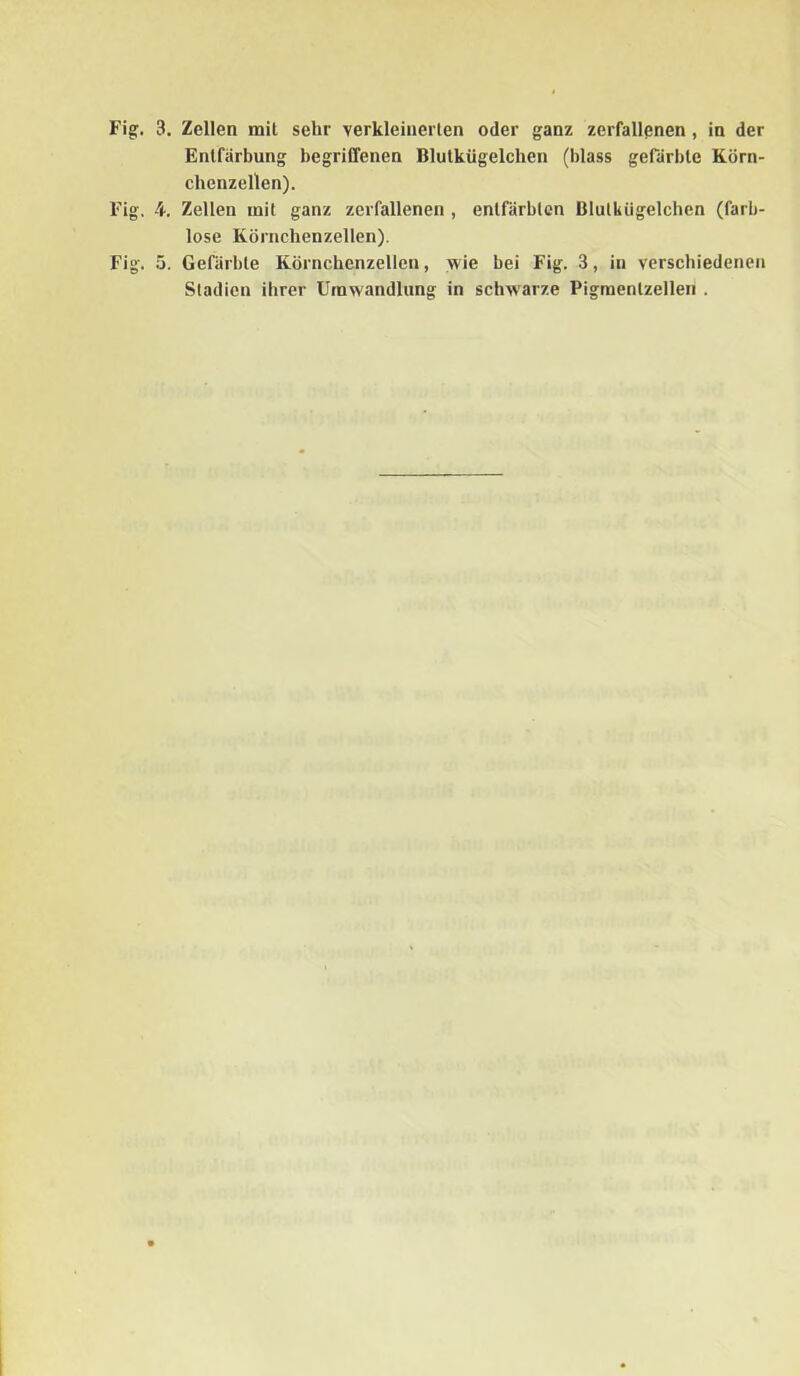 Fig. 3. Zellen mit sehr verkleinerten oder ganz zerfallenen , in der Entfärbung begriffenen Blutkügelchen (blass gefärbte Körn- chenzellen). Fig. 4. Zellen mit ganz zerfallenen , entfärbten Blutkügelchen (farb- lose Körnchenzellen). Fig. 5. Gefärbte Körnchenzellen, wie bei Fig. 3, in verschiedenen Stadien ihrer Umwandlung in schwarze Pigmenlzellen .