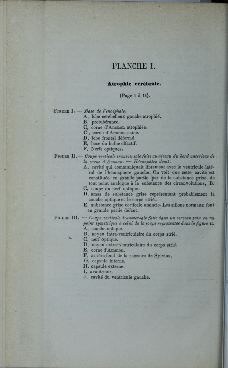Atrophie cérébrale. (Page 1 à 14). Figure I. — Base de l'encéphale» A, lobe cérébelleux gauche atrophié. B, protubérance. C, corne d’Ammon atrophiée. C’, corne d’Ammon saine. D, lobe frontal déformé. E, base du bulbe olfactif. F, Nerfs optiques. Figure II. — Coupe verticale transver sale, faite au niveau du lord antérieur de la corne d’Ammon. — Hémisphère droit. A, cavité qui communiquait librement avec le ventricule laté- ral de l’hémisphère gauche. On voit que cette cavité est constituée en grande partie par de la substance grise, de tout point analogue à la substance des circonvolutions, B. C, coupe du nerf optique. D, amas de substance grise représentant probablement la couche optique et le corps strié. E, substance grise corticale amincie. Les sillons normaux font en grande partie défaut. Figure III. — Coupe verticale transversale faite dans un cerveau sain en un point symétrique à celui de la soupe représentée dans la figure n. A, couche optique. B, noyau intra-ventriculaire du corps strié. * C, nerf optique. D, noyau extra-ventriculaire du corps strié. E, corne d’Ammon. F, arrière-fond de la scissure de Sylvius. G, capsule interne. H, capsule externe. I, avant-mur. J, cavité du ventricule gauche.