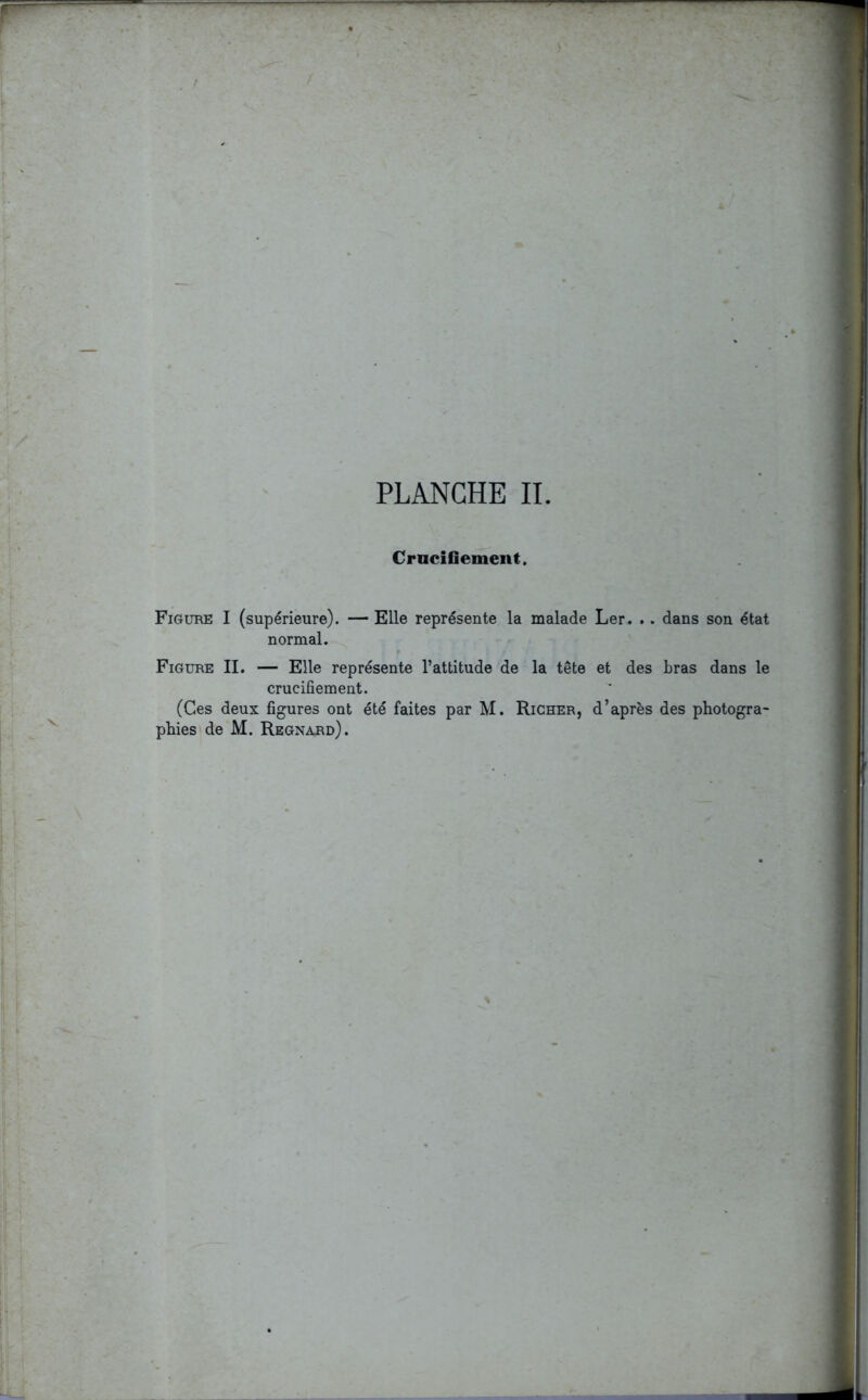 Crucifiement. Figure I (supérieure). — Elle représente la malade Ler. . . dans son état normal. Figure IL — Elle représente l’attitude de la tête et des bras dans le crucifiement. (Ces deux figures ont été faites par M. Richer, d’après des photogra-