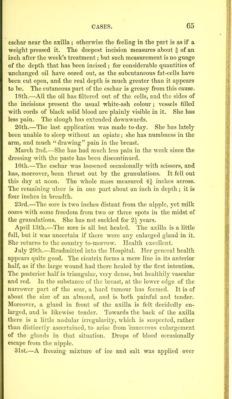 eschar near the axilla ; otherwise the feeling in the part is as if a weight pressed it. The deepest incision measures about f of an inch after the week’s treatment; but such measurement is no guage of the depth that has been incised ; for considerable quantities of unchanged oil have oozed out, as the subcutaneous fat-cells have been cut open, and the real depth is much greater than it appears to be. The cutaneous part of the eschar is greasy from this cause. 18th.—All the oil has filtered out of the cells, and the sides of the incisions present the usual white-ash colour ; vessels filled with cords of black solid blood are plainly visible in it. She has less pain. The slough has extended downwards. 26th.—The last application was made to-day. She has lately been unable to sleep without an opiate; she has numbness in the arm, and much “ drawing” pain in the breast. March 2nd.—She has had much less pain in the week since the dressing with the paste has been discontinued. 10th.—The eschar was loosened occasionally with scissors, and has, moreover, been thrust out by the granulations. It fell out this day at noon. The whole mass measured 4f inches across. The remaining ulcer is in one part about an inch in depth; it is four inches in breadth. 23rd.—The sore is two inches distant from the nipple, yet milk oozes wfith some freedom from two or three spots in the midst of the granulations. She has not suckled for years. April 13th.—The sore is all but healed. The axilla is a little full, but it was uncertain if there were any enlarged gland in it. She returns to the country to-morrow. Health excellent. July 29th.—Readmitted into the Hospital. Her general health appears quite good. The cicatrix forms a mere line in its anterior half, as if the large wound had there healed by the first intention. The posterior half is triangular, very dense, but healthily vascular and red. In the substance of the breast, at the lower edge of the narrower part of the scar, a hard tumour has formed. It is of about the size of an almond, and is both painful and tender. Moreover, a gland in front of the axilla is felt decidedly en- larged, and is likewise tender. Towards the back of the axilla there is a little nodular irregularity, which is suspected, rather than distinctly ascertained, to arise from cancerous enlargement of the glands in that situation. Drops of blood occasionally escape from the nipple. 31st.—A freezing mixture of ice and salt was applied over