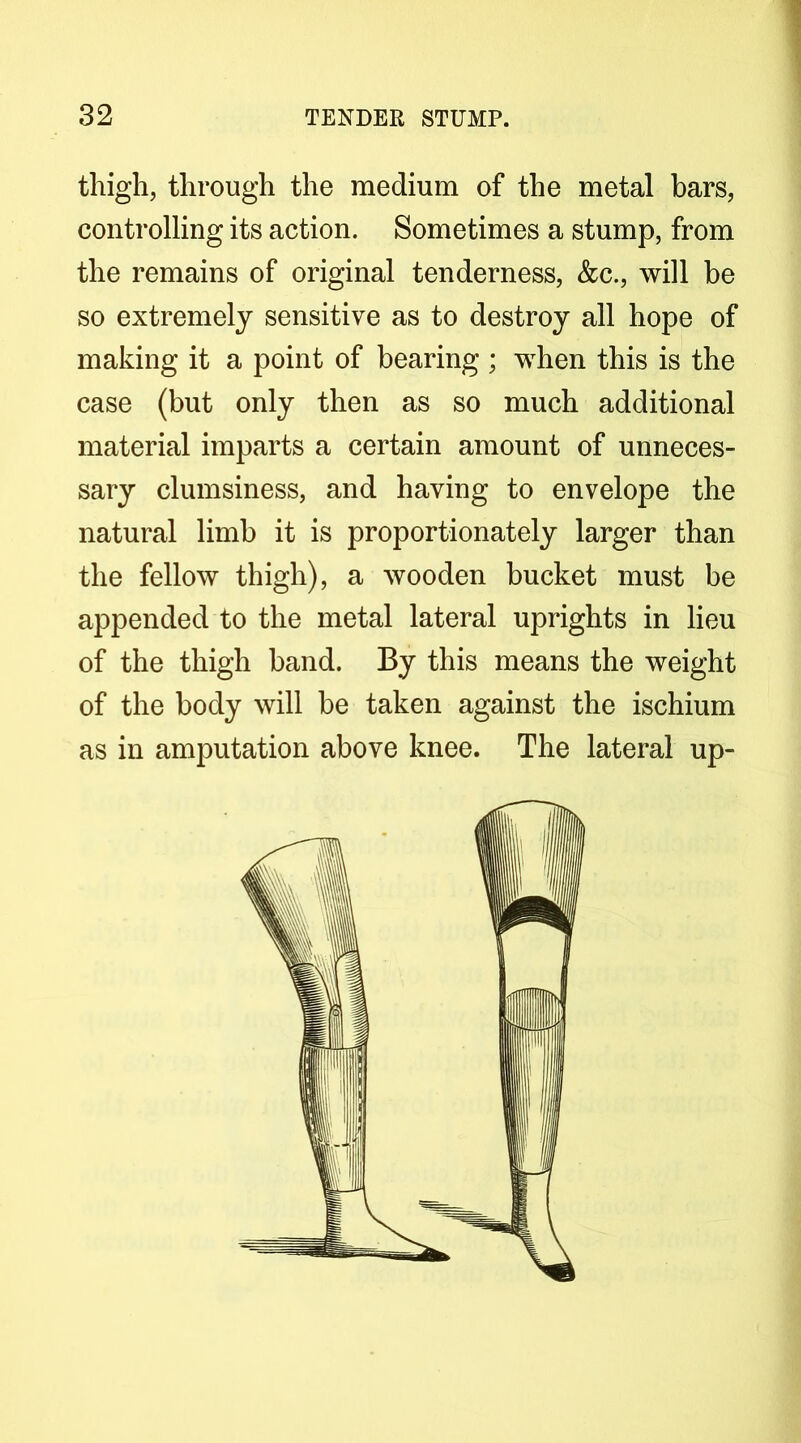 1 thigh, through the medium of the metal bars, controlling its action. Sometimes a stump, from the remains of original tenderness, &c., will be so extremely sensitive as to destroy all hope of making it a point of bearing ; when this is the case (but only then as so much additional material imparts a certain amount of unneces- sary clumsiness, and having to envelope the natural limb it is proportionately larger than the fellow thigh), a wooden bucket must be appended to the metal lateral uprights in lieu of the thigh band. By this means the weight of the body will be taken against the ischium as in amputation above knee. The lateral up-