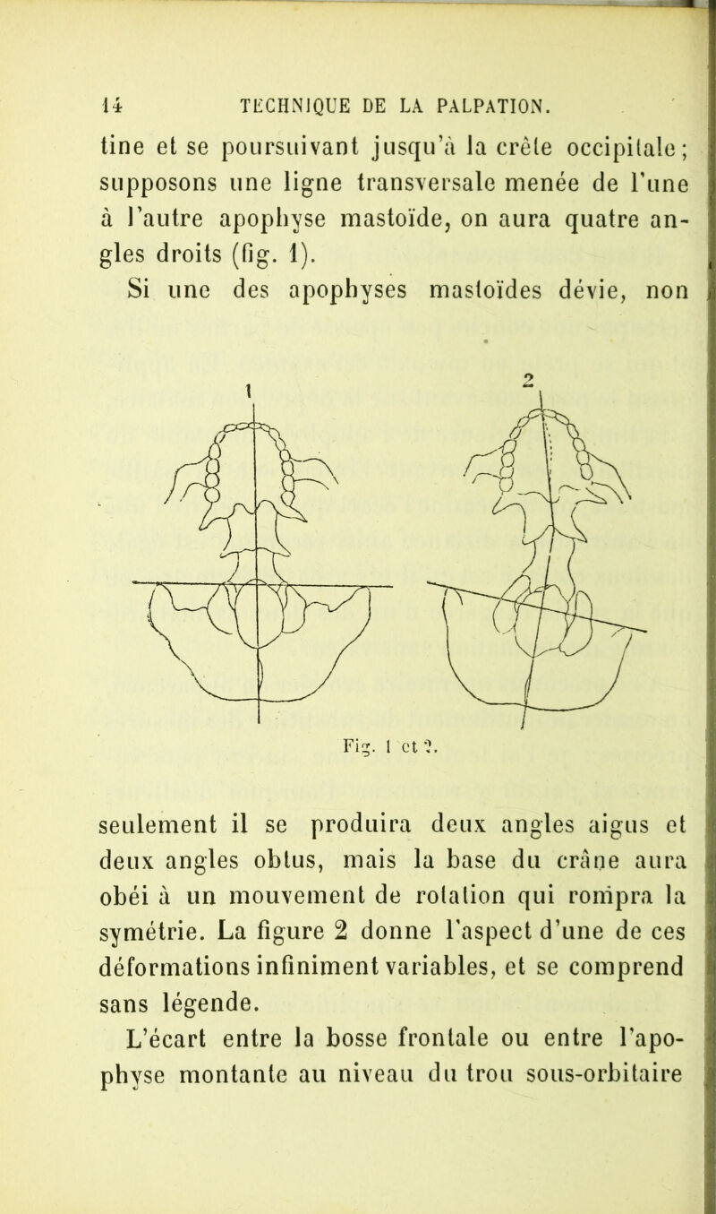 tine et se poursuivant jusqu’à la crête occipitale; supposons une ligne transversale menée de l’une à l’autre apophyse mastoïde, on aura quatre an- gles droits (fig. 1). Si une des apophyses mastoïdes dévie, non seulement il se produira deux angles aigus et deux angles obtus, mais la base du crâne aura obéi à un mouvement de rotation qui rompra la symétrie. La figure 2 donne l’aspect d’une de ces déformations infiniment variables, et se comprend sans légende. L’écart entre la bosse frontale ou entre l’apo- physe montante au niveau du trou sous-orbitaire
