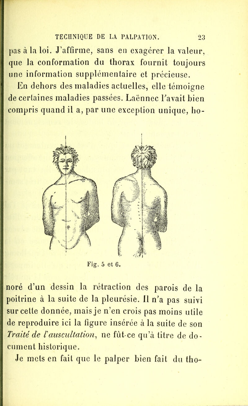 pas à la loi. J’affirme, sans en exagérer la valeur, que la conformation du thorax fournit toujours une information supplémentaire et précieuse. En dehors des maladies actuelles, elle témoigne de certaines maladies passées. Laënnec l’avait bien compris quand il a, par une exception unique, ho- Fig. 5 et 6. noré d’un dessin la rétraction des parois de la poitrine à la suite de la pleurésie. 11 n’a pas suivi sur cette donnée, mais je n’en crois pas moins utile de reproduire ici la figure insérée à la suite de son Traité de l'auscultation, ne fût-ce qu’à titre de do- cument historique. Je mets en fait que le palper bien fait du tho-