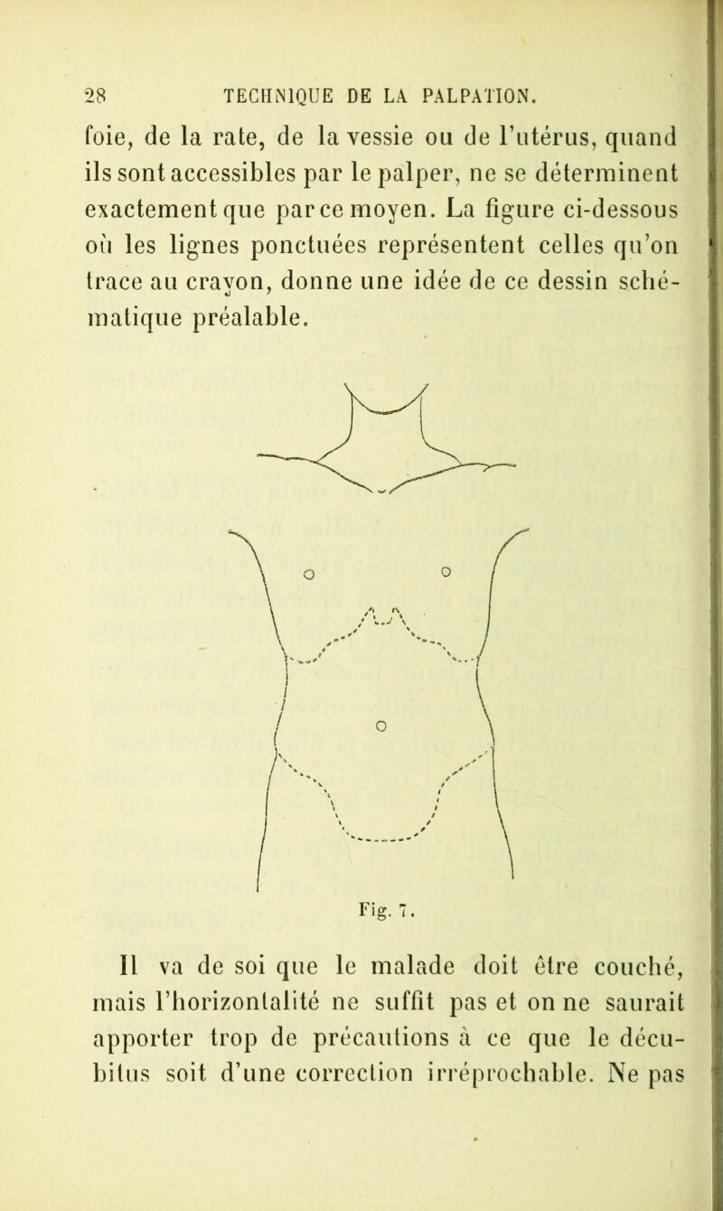 foie, de la rate, de la vessie ou de l’utérus, quand ils sont accessibles par le palper, ne se déterminent exactement que parce moyen. La figure ci-dessous où les lignes ponctuées représentent celles qu’on trace au crayon, donne une idée de ce dessin sché- matique préalable. Fig. 7. Il va de soi que le malade doit être couché, mais l’horizontalité ne suffit pas et on ne saurait apporter trop de précautions à ce que le décu- bitus soit d’une correction irréprochable. Ne pas