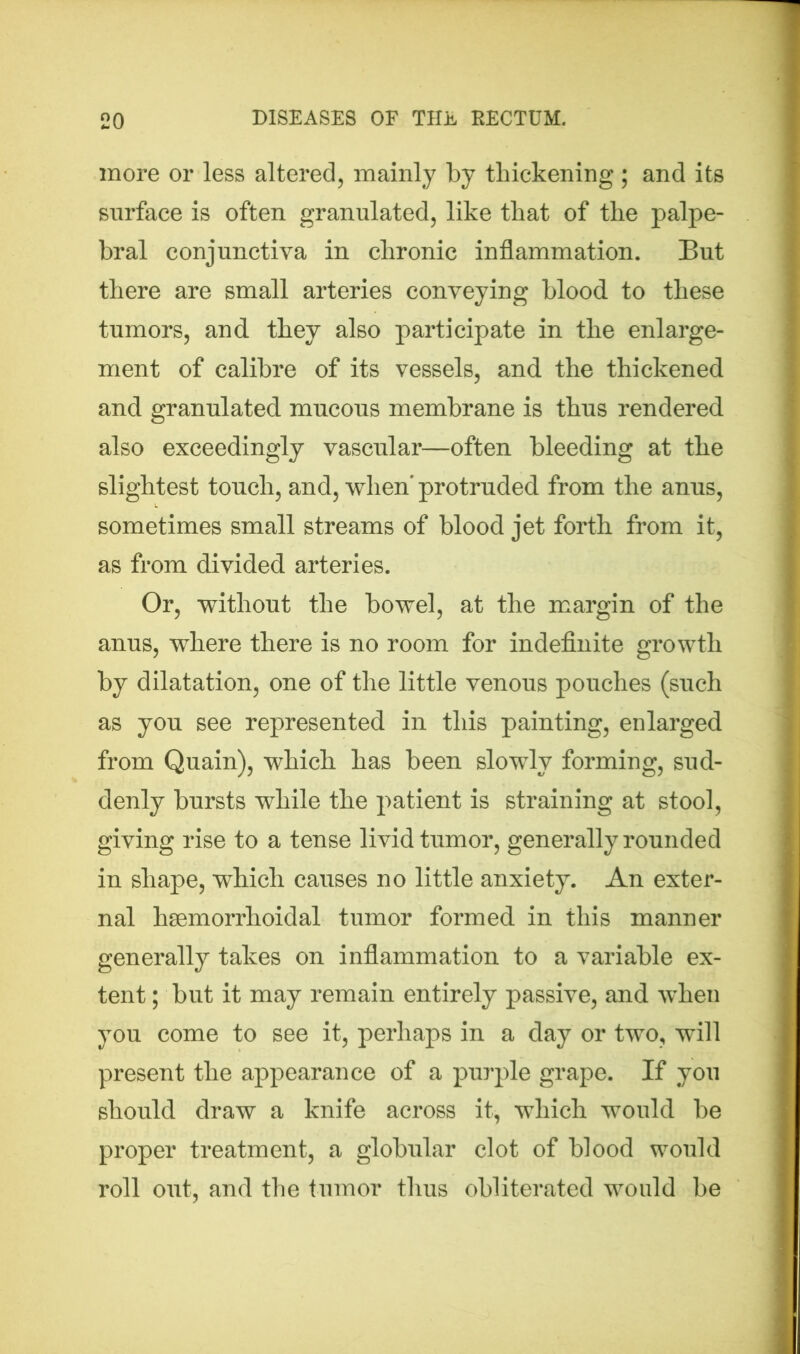 more or less altered, mainly by thickening ; and its surface is often granulated, like that of the palpe- bral conjunctiva in chronic inflammation. But there are small arteries conveying blood to these tumors, and they also participate in the enlarge- ment of calibre of its vessels, and the thickened and granulated mucous membrane is thus rendered also exceedingly vascular—often bleeding at the slightest touch, and, when' protruded from the anus, sometimes small streams of blood jet forth from it, as from divided arteries. Or, without the bowel, at the margin of the anus, where there is no room for indefinite growth by dilatation, one of the little venous pouches (such as you see represented in this painting, enlarged from Quain), which has been slowly forming, sud- denly bursts while the patient is straining at stool, giving rise to a tense livid tumor, generally rounded in shape, which causes no little anxiety. An exter- nal hsemorrhoidal tumor formed in this manner generally takes on inflammation to a variable ex- tent ; but it may remain entirely passive, and when you come to see it, perhaps in a day or two, will present the appearance of a purple grape. If you should draw a knife across it, which would be proper treatment, a globular clot of blood would roll out, and the tumor thus obliterated would be