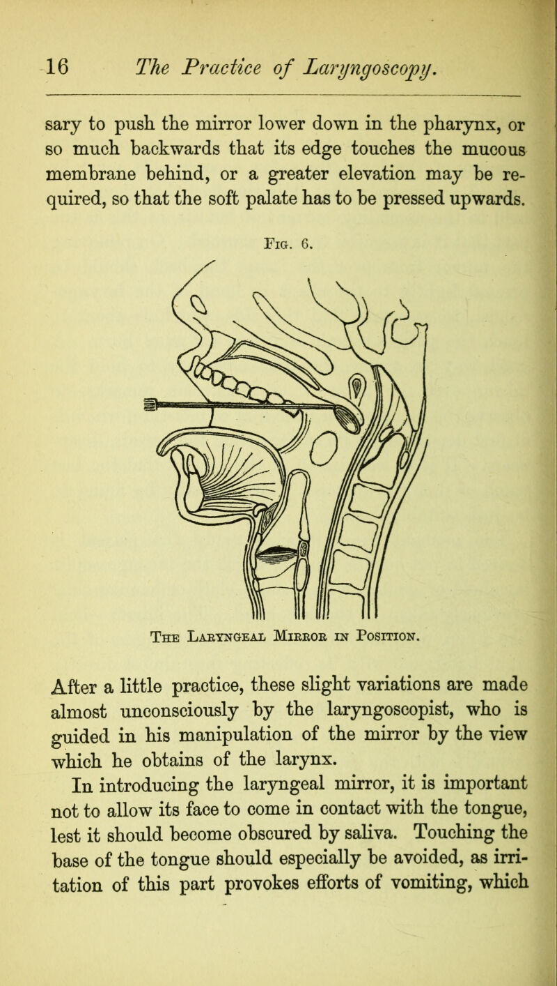 sary to push the mirror lower down in the pharynx, or so much backwards that its edge touches the mucous membrane behind, or a greater elevation may he re- quired, so that the soft palate has to he pressed upwards. Fig. 6. After a little practice, these slight variations are made almost unconsciously by the laryngoscopist, who is ; guided in his manipulation of the mirror by the view which he obtains of the larynx. In introducing the laryngeal mirror, it is important not to allow its face to come in contact with the tongue, i lest it should become obscured by saliva. Touching the base of the tongue should especially be avoided, as irri- tation of this part provokes efforts of vomiting, which