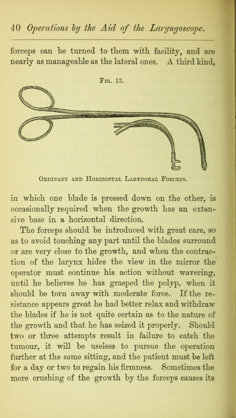 forceps can be turned to them with facility, and are nearly as manageable as the lateral ones. A third kind, Fia. 13. Oedinaey and Hoeizontal Laetngeal Foeceps. in which one blade is pressed down on the other, is occasionally required when the growth has an exten- sive base in a horizontal direction. The forceps should be introduced with great care, so as to avoid touching any part until the blades surround or are very close to the growth, and when the contrac- tion of the larynx hides the view in the mirror the operator must continue his action without wavering, until he believes he has grasped the polyp, when it should be torn away with moderate force. If the re- sistance appears great he had better relax and withdraw the blades if he is not quite certain as to the nature of the growth and that he has seized it properly. Should two or three attempts result in failure to catch the tumour, it will be useless to pursue the operation further at the same sitting, and the patient must be left for a day or two to regain his firmness. Sometimes the mere crushing of the growth by the forceps causes its