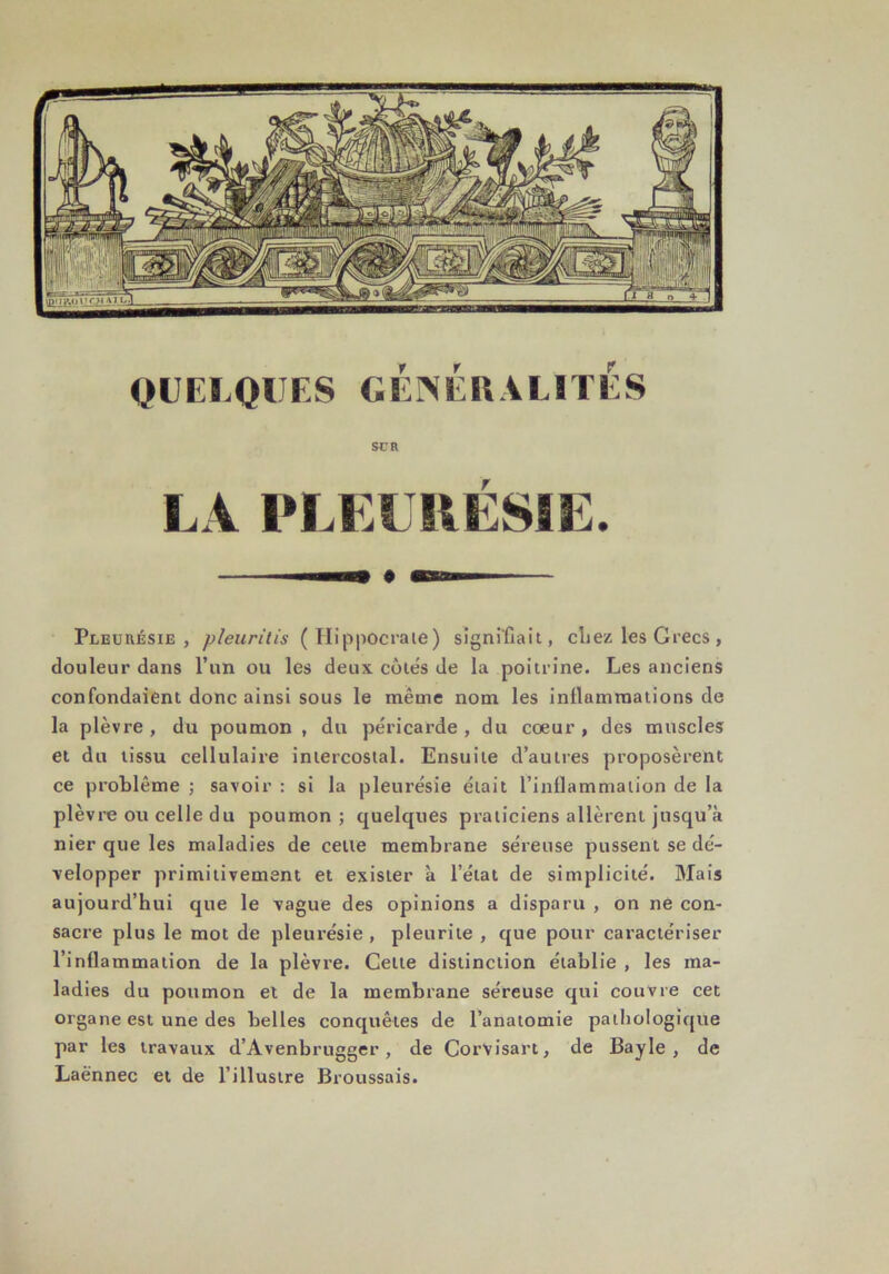 Pleurésie, pleuritis (Hippocrate) signifiait, cliez les Grecs, douleur dans l’un ou les deux côtés de la poitrine. Les anciens confondaient donc ainsi sous le même nom les inflammations de la plèvre , du poumon , du péricarde , du coeur , des muscles et du tissu cellulaire intercostal. Ensuite d’autres proposèrent ce problème ; savoir : si la pleurésie était l’inflammation de la plèvre ou celle du poumon; quelques praticiens allèrent jusqu’à nier que les maladies de cette membrane séreuse pussent se dé- velopper primitivement et exister à l’état de simplicité. Mais aujourd’hui que le vague des opinions a disparu , on ne con- sacre plus le mot de pleurésie , pleurite , que pour caractériser l’inflammation de la plèvre. Celte distinction établie , les ma- ladies du poumon et de la membrane séreuse qui couvre cet organe est une des belles conquêtes de l’anatomie pathologique par les travaux d’Avenbrugger , de Corvisart, de Bayle, de Laënnec et de l’illustre Broussais.