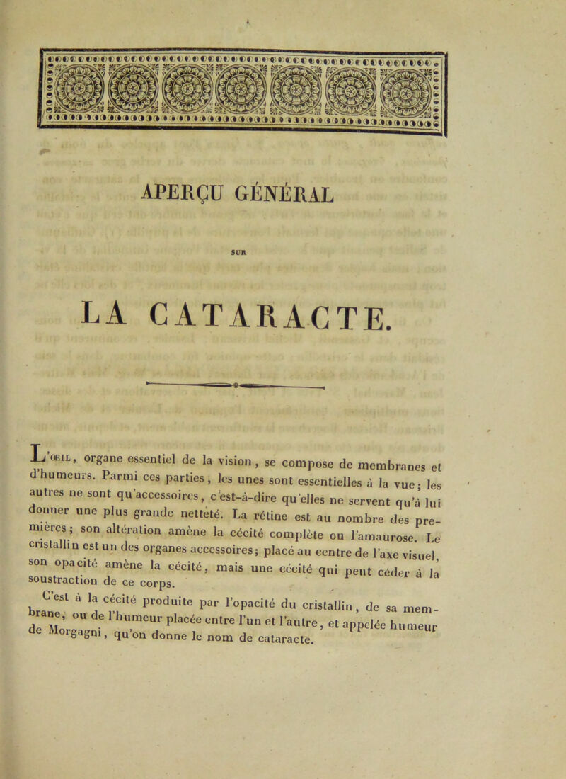 lOeftccccccct-'CicccctJtxioccBccccco'cmacrtirrrrr.»->>. .... ...— S.wr^SaE^ÎHS Sf^-SS=WÏ&J-l!5 iRÆ^^IK .._ T_” »-'*:» H1»- • I» 19 '% 9 * * * * * * *c*^<* <*» «v«y» TaTT»»1’»ooof>,»,»d APERÇU GÉNÉRAL SUR LA CATARACTE. L œil, organe essentiel de la vision , se compose de membranes et d humeurs. Parmi ces parties, les unes sont essentielles à la vue - les autres ne sont qu’accessoires, cest-à-dire qu elles ne servent qu a’ lui donner une plus grande netteté. La rétine est au nombre des pre- mières; son altération amène la cécité complète ou l’amaurose. le cristallin est un des organes accessoires; placé au centre de l’axe visuel son opacité amène la cécité, mais une cécité qui peut céder à h soustraction de ce corps. C’est à la cécité produite par l’opacité du cristallin, de sa mem- <1 Mo^a11 T PlaCé° e're ,U Ct « épelée humeur de Morgagn., qu’on donne le nom de cataracte.