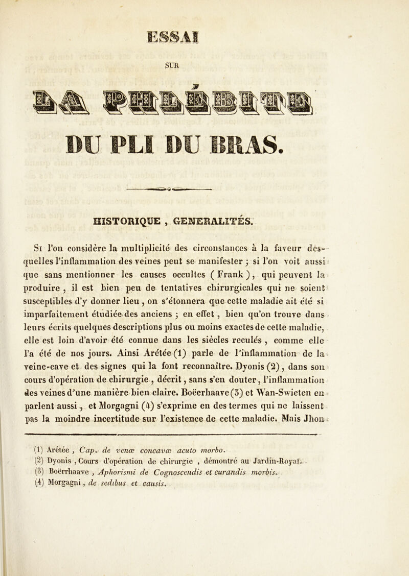 DU PLI DU BRAS. HISTORIQUE , GENERALITES: Si Ton considère la multiplicité des circonstances à la faveur des-- cpelles l’inflammation des veines peut se manifester } si l’on voit aussi^ que sans mentionner les causes occultes (Frank), qui peuvent la produire , il est bien peu de tentatives chirurgicales qui ne soient susceptibles d’y donner lieu , on s’étonnera que cette maladie ait été si imparfaitement étudiée des anciens 3 en effet, bien qu’on trouve dans leurs écrits quelques descriptions plus ou moins exactes de celte maladie, elle est loin d’avoir été connue dans les siècles reculés , comme elle l’a été de nos jours* Ainsi Arétée (1) parle de l’inflammation de la ^» veine-eave et . des signes qui la font reconnaître. Dyonis (2) , dans son cours d’opération de chirurgie , décrit, sans s’en douter, l’inflammation des veines d’une manière bien claire. Boëerbaave(3) et Wan-Swieten en^ parlent aussi, et Morgagni (^) s’exprime en des termes qui ne laissent pas la moindre incertitude sur l’existence de cette maladie. Mais Jhou : (1) Arétée , Cap.' de venœ concavœ acuto morbo. (2) Dyonis , Cours d’opération de chirurgie , démontré au Jardin-Royale (3) Boërrtiaave , Aphorismi de Cognoscendis et curandis morbis. (4) Morgagni, de sedibus et causis. I