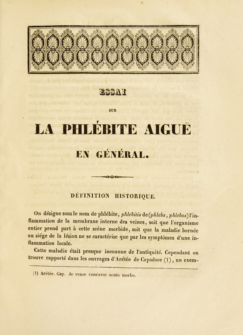 SUR LA PHLÉBITE AIGUË EK GÉKÉRAL. ■■I Qi ■ DÉFINITION HISTORIQUE. Ou désigne sous le nom de phlébite, phlelùts de(phlebs, phlebos)l’in- Ilammation de la membrane interne des veines, soit que l’organisme entier prend part à cette scène morbide, soit que la maladie bornée au siège de la lésion ne se caractérise que par les symptômes d’une in- flammation locale. Cette maladie était presque inconnue de l’antiquité. Cependant on trouve rapporté dans les ouvrages d’Arétée de Capadoce (1), un excm- (I) Arétée. Cap. de venœ concavœ acuto morbo.