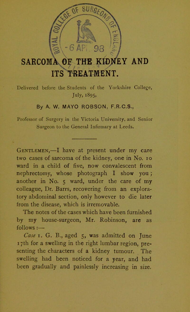 Delivered before the Students of the Yorkshire College, July, 1895, By A. W. MAYO ROBSON, F.R.C.S., Professor of Surgery in the Victoria University, and Senior Surgeon to the General Infirmary at Leeds. Gentlemen,—I have at present under my care two cases of sarcoma of the kidney, one in No. 10 ward in a child of five, now convalescent from nephrectomy, whose photograph I show you; another in No. 5 ward, under the care of my colleague, Dr. Barrs, recovering from an explora- tory abdominal section, only however to die later from the disease, which is irremovable. The notes of the cases which have been furnished by my house-surgeon, Mr. Robinson, are as follows :— Case 1. G. B., aged 5, was admitted on June 17th for a swelling in the right lumbar region, pre- senting the characters of a kidney tumour. The swelling had been noticed for a year, and had been gradually and painlessly increasing in size.