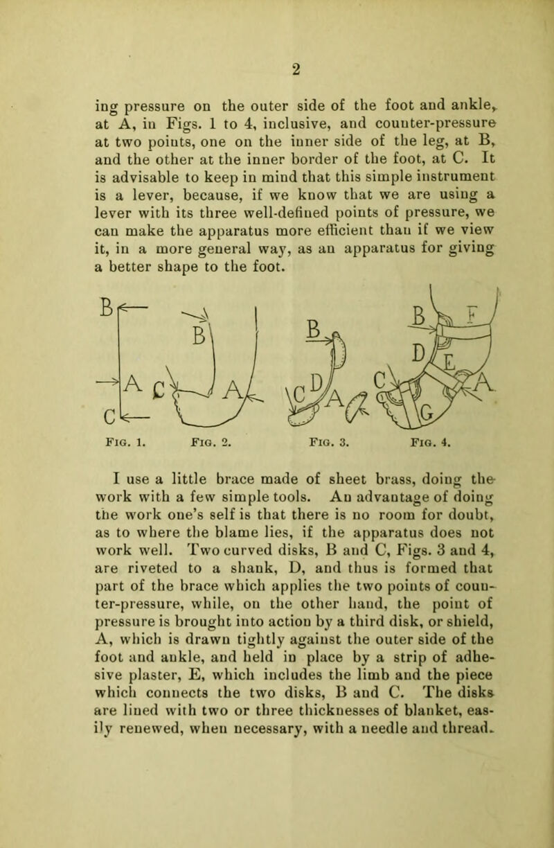 ing pressure on the outer side of the foot and ankle,, at A, in Figs. 1 to 4, inclusive, and counter-pressure at two points, one on the inner side of the leg, at B, and the other at the inner border of the foot, at C. It is advisable to keep in mind that this simple instrument is a lever, because, if we know that we are using a lever with its three well-defined points of pressure, we can make the apparatus more efficient thau if we view it, in a more general way, as an apparatus for giving a better shape to the foot. I use a little brace made of sheet brass, doing the- work with a few simple tools. An advantage of doing the work one’s self is that there is no room for doubt, as to where the blame lies, if the apparatus does not work well. Two curved disks, B and C, Figs. 3 and 4, are riveted to a shank, D, and thus is formed that part of the brace which applies the two points of coun- ter-pressure, while, on the other hand, the point of pressure is brought into action by a third disk, or shield, A, which is drawn tightly against the outer side of the foot and ankle, and held in place by a strip of adhe- sive plaster, E, which includes the limb and the piece which connects the two disks, B and C. The disks are lined with two or three thicknesses of blanket, eas- ily renewed, when necessary, with a needle and thread.